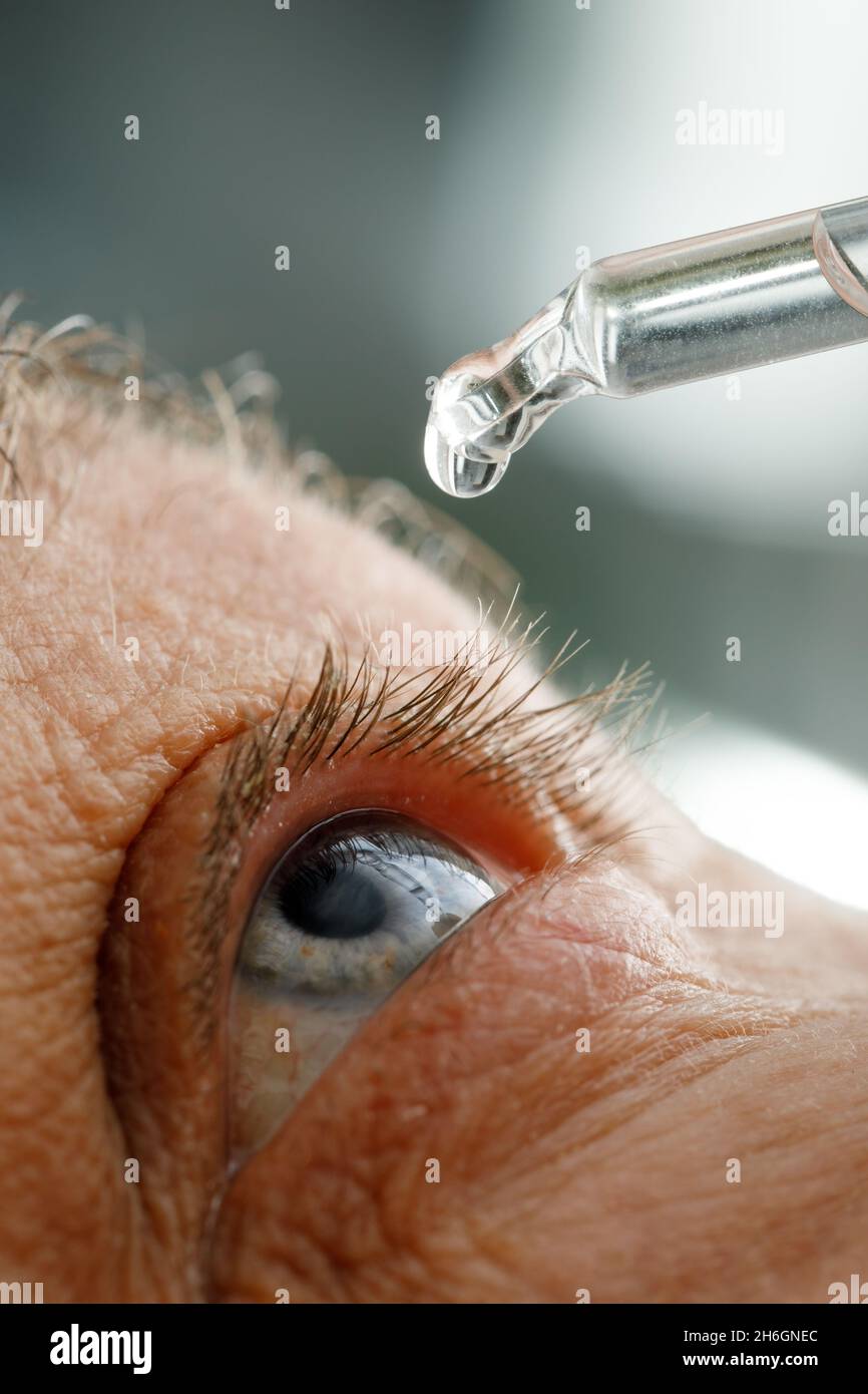 A man moistens his eyes before installing contact lenses. Drops in the eyes from irritation