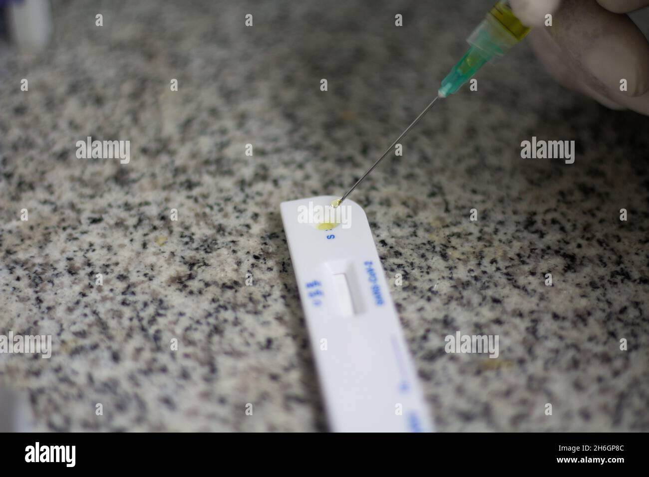 Where Test Inject Close up of a syringe inject a drop of blood on a medical small device ...