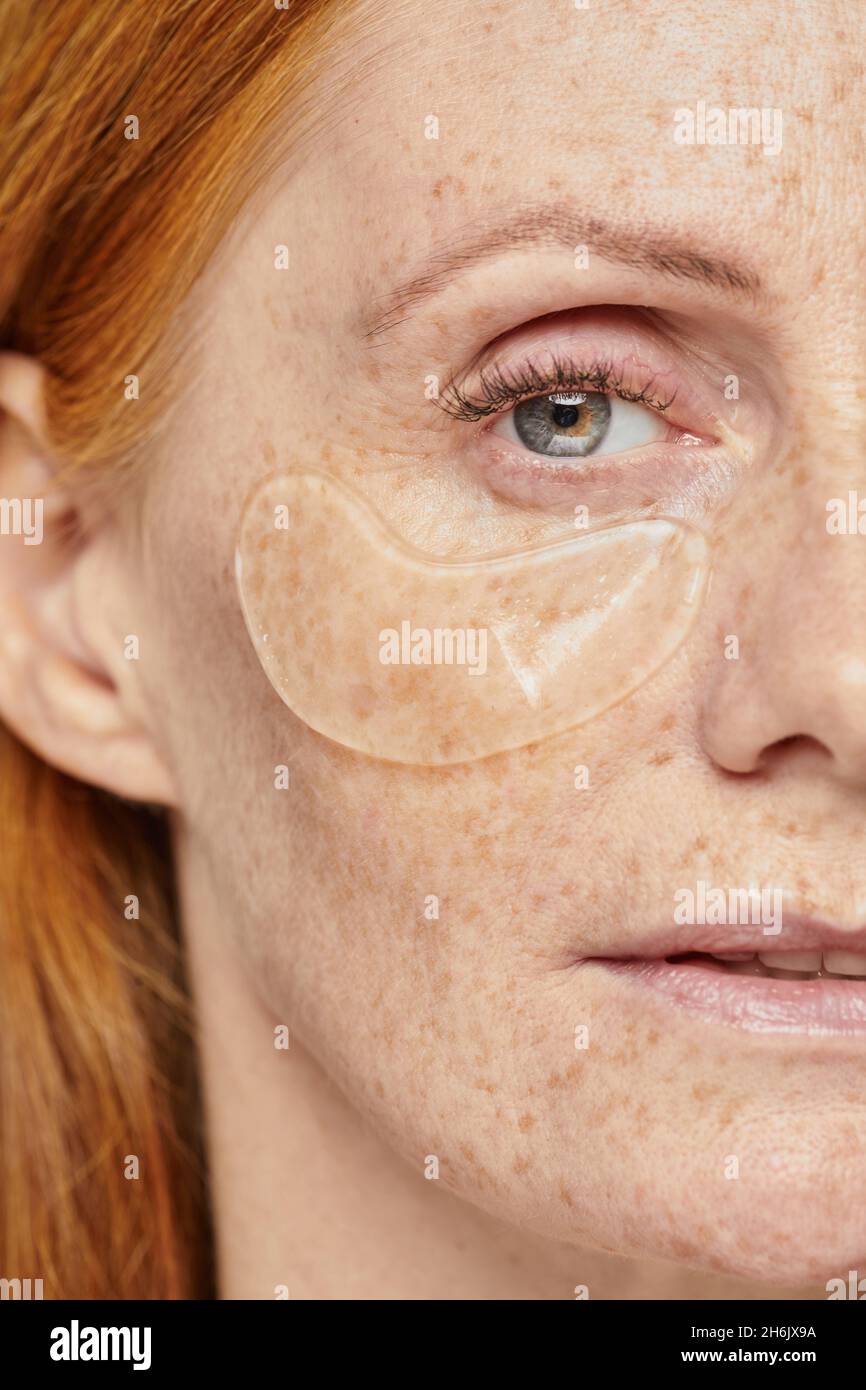 Half face portrait of beautiful red haired woman with freckles enjoying skincare using moisturizing patches Stock Photo