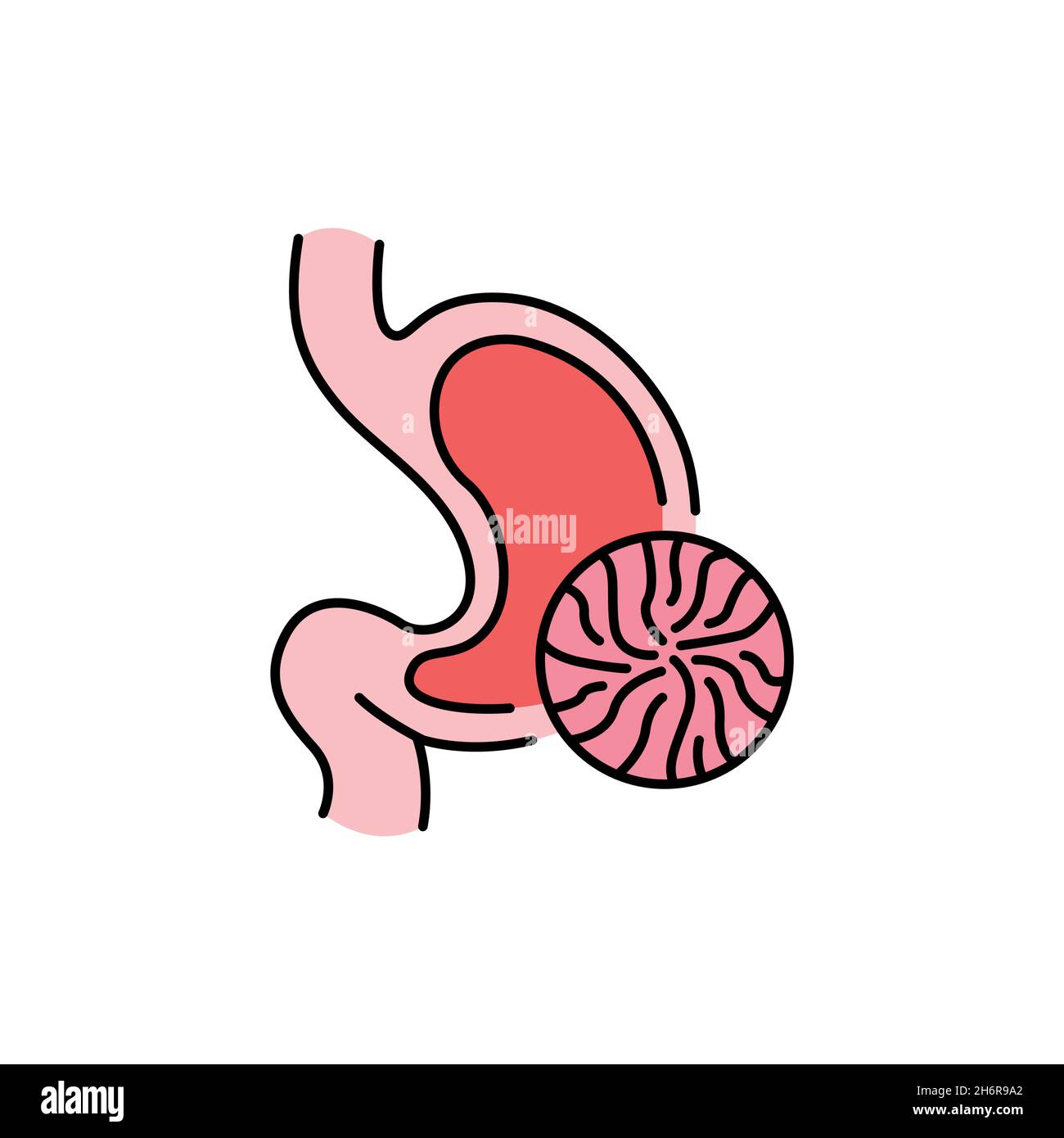 Gastric diseases hi-res stock photography and images - Page 2 - Alamy