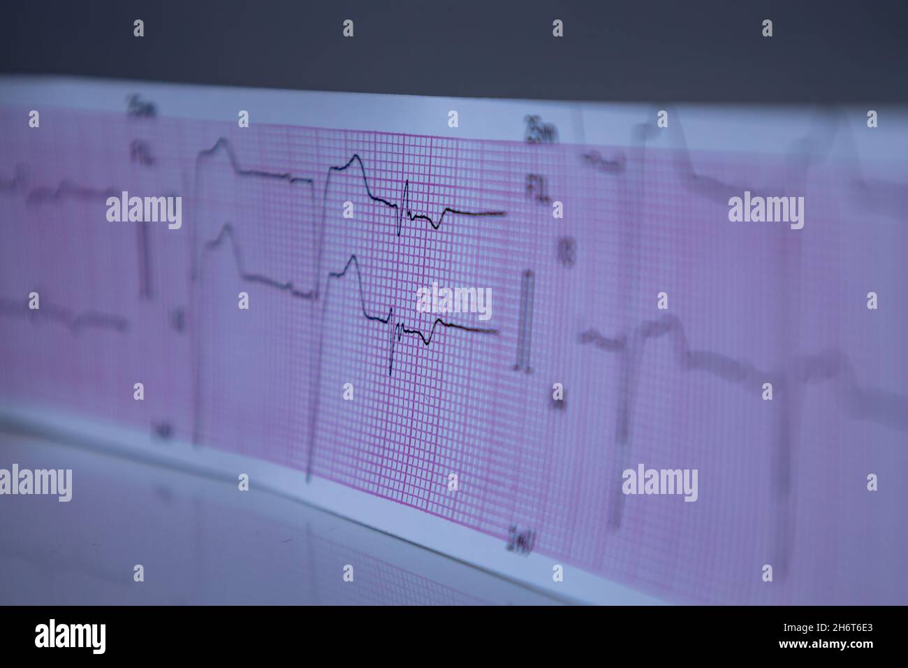 Electrocardiogram graph ekg heart rhythm hi-res stock photography and ...