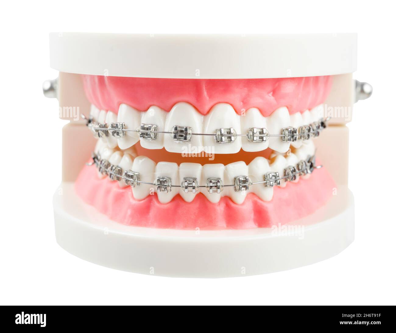 Teeth model wire dental braces isolated on white background, save clipping path. Stock Photo