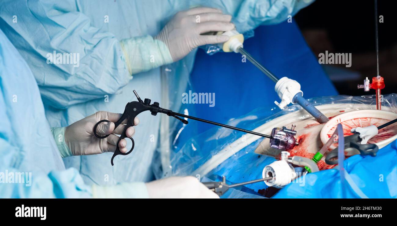 Selective focus on laparoscopic instruments in the hands of surgeons during  surgery. Forceps and trocars in the patient's body. Minimally invasive  surgery Stock Photo - Alamy