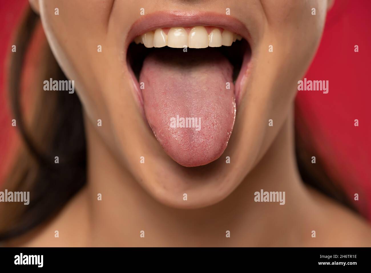 Split in middle of tongue