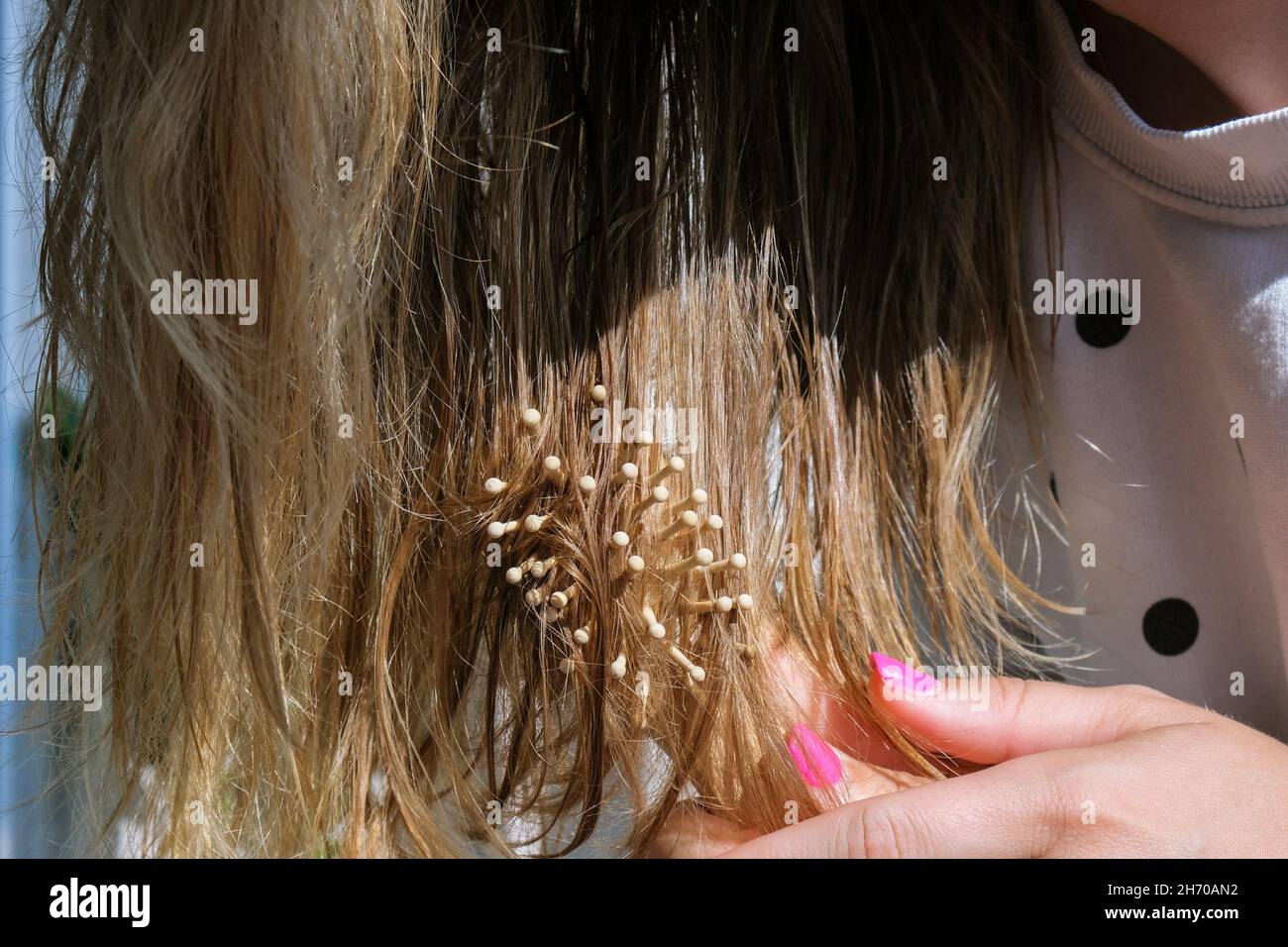 Clumps of hair hires stock photography and images  Alamy