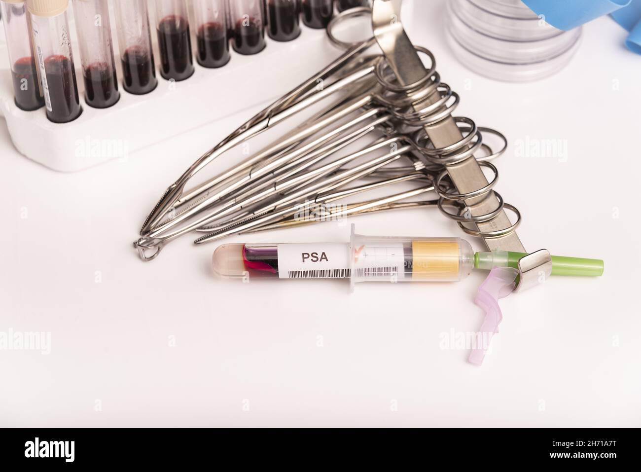 Blood sample with abnormal high PSA test result Stock Photo Alamy