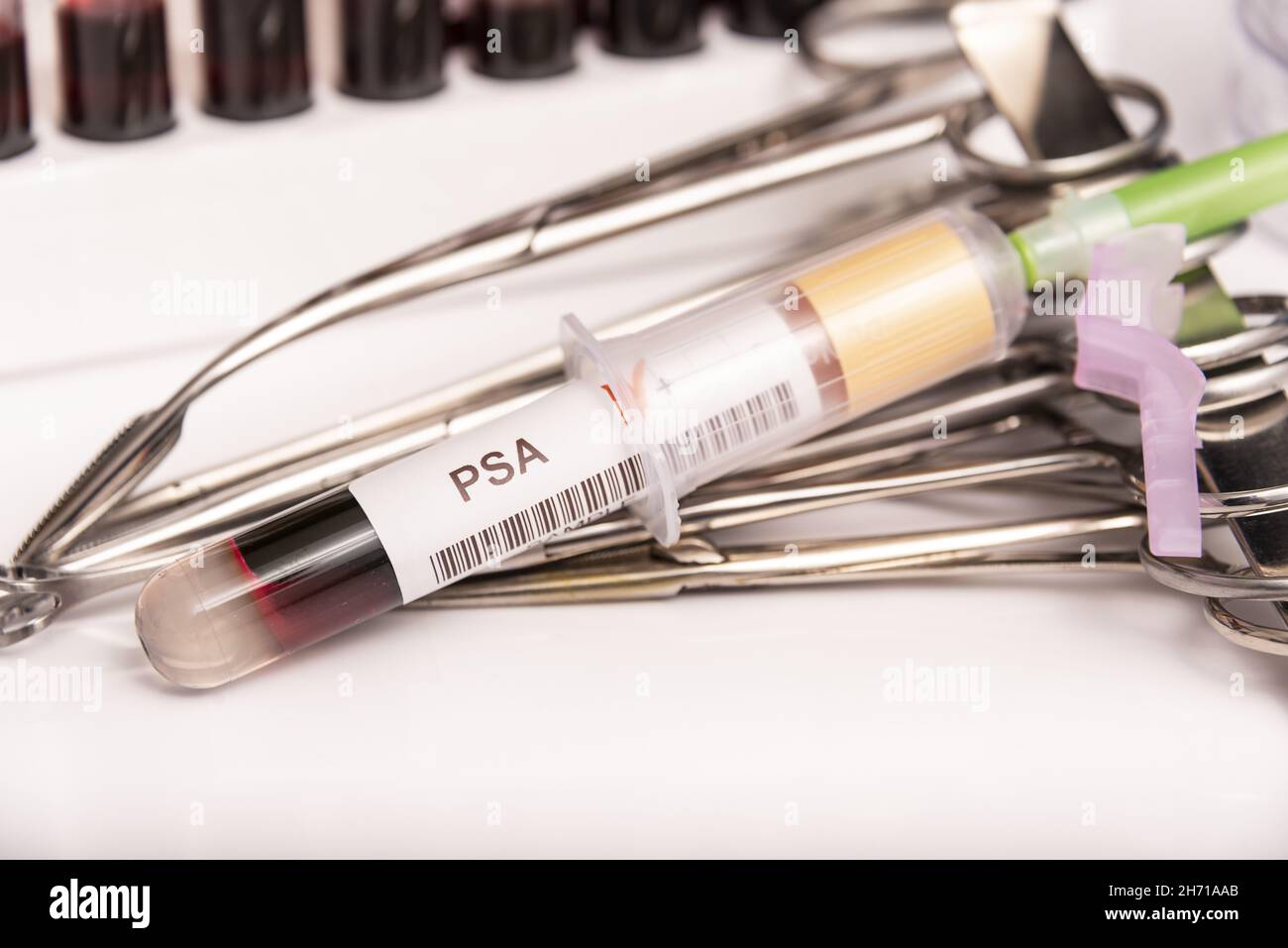 Blood sample with abnormal high PSA test result Stock Photo Alamy