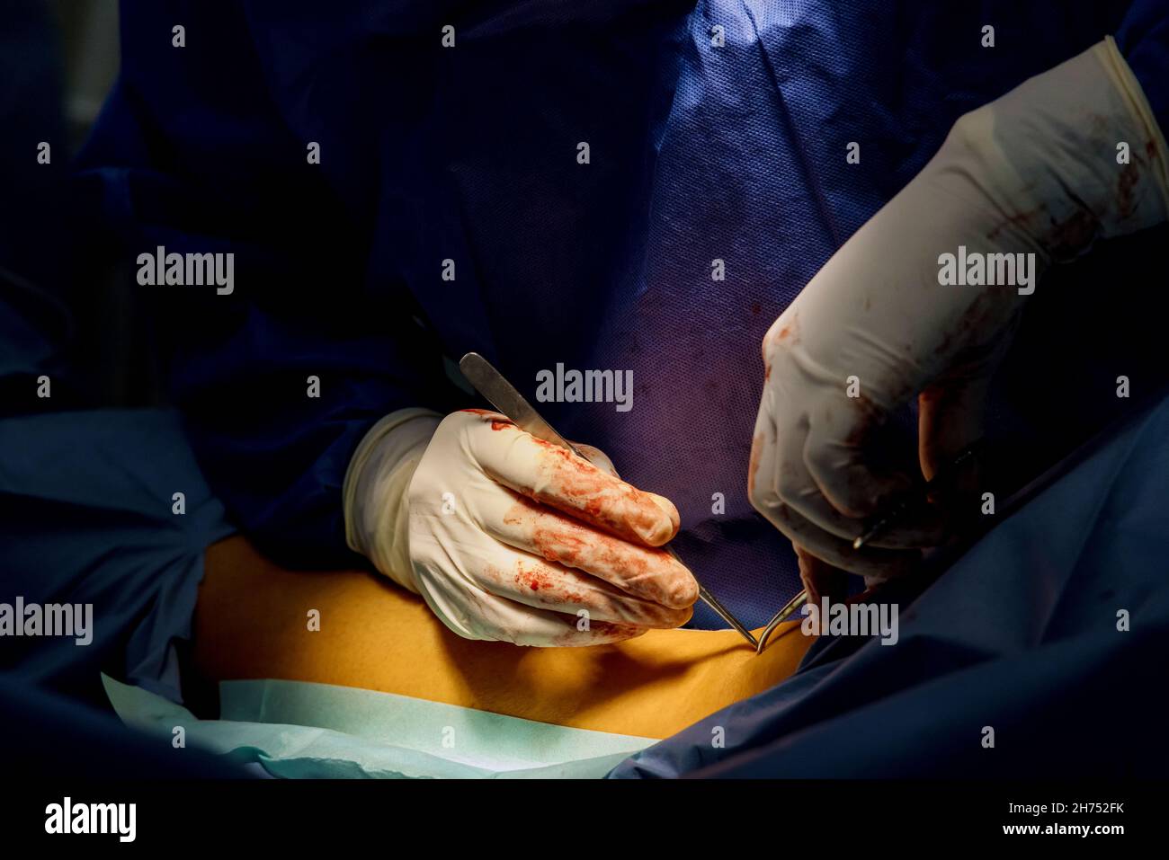 Doctor surgeon prepared leg for surgery with hospital emergency operating room Stock Photo
