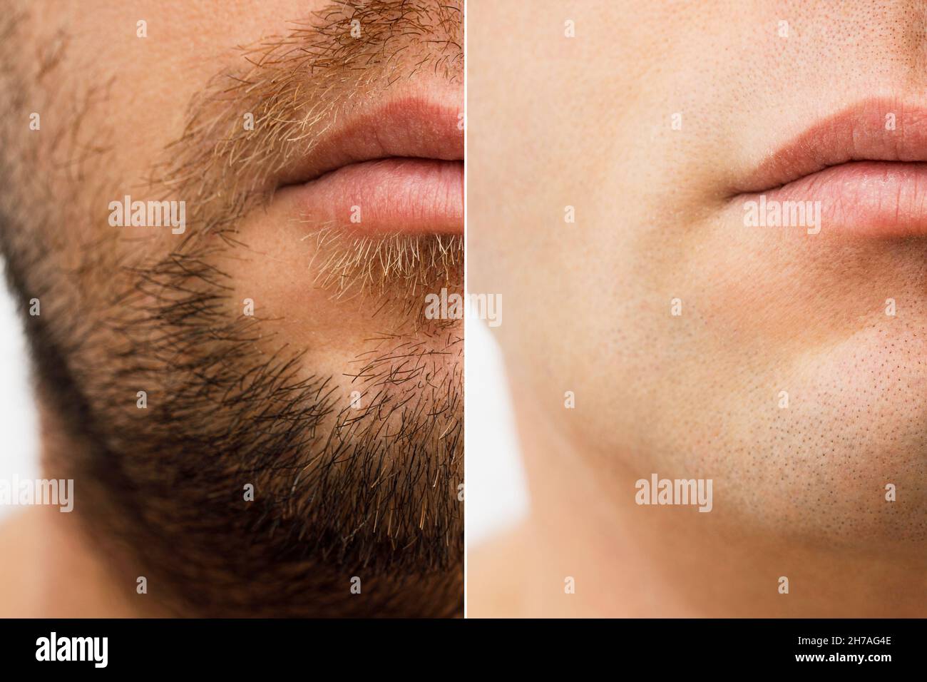 Close up photo of a man's face before and after shaving. a young man with a beard. Comparison of a man's face with a beard and without a beard. use of Stock Photo