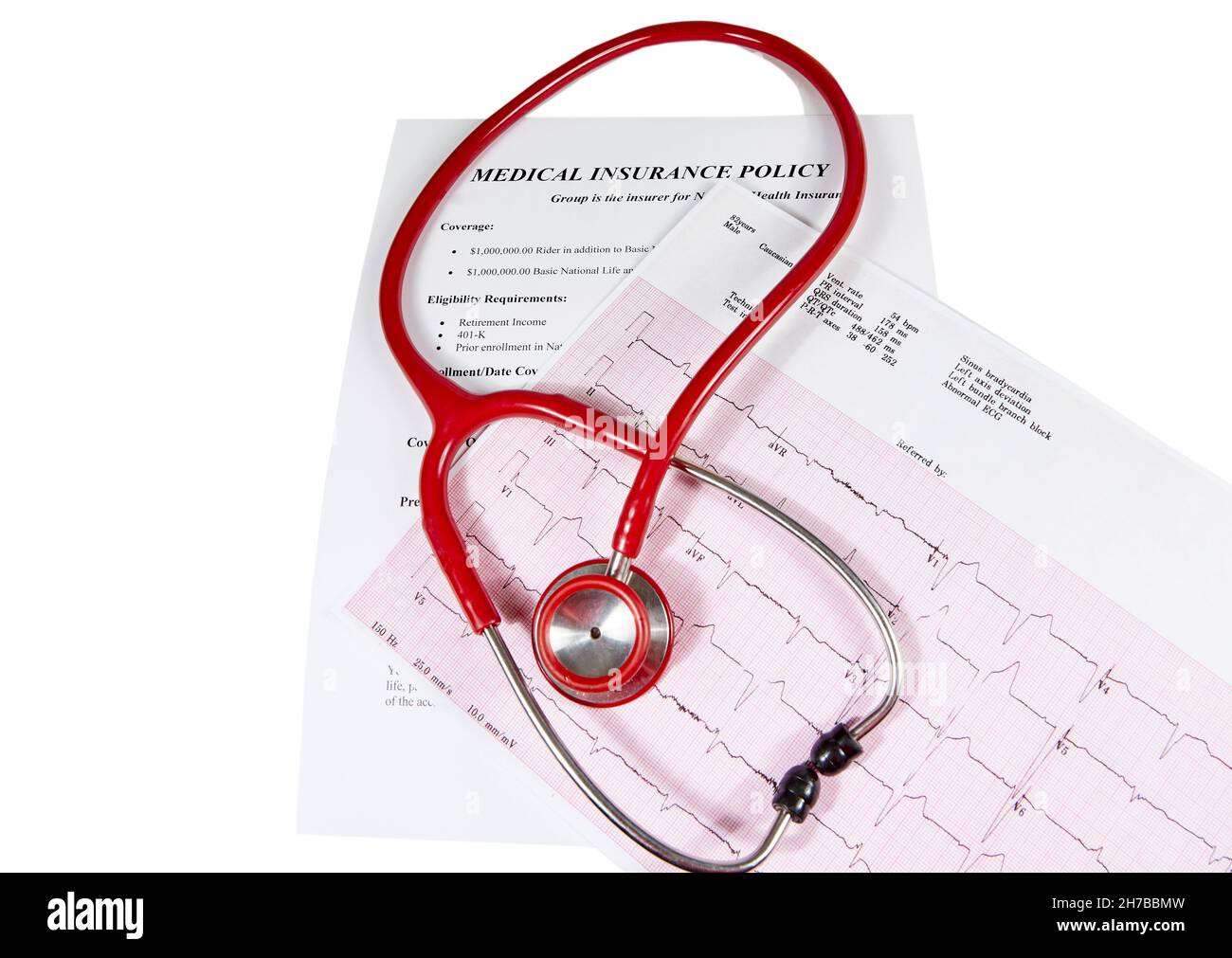 Ecocardiography report (ECG) showing irregular heartbeat with a medical insurance policy underneath and a red stethoscope on top of it isolated on whi Stock Photo