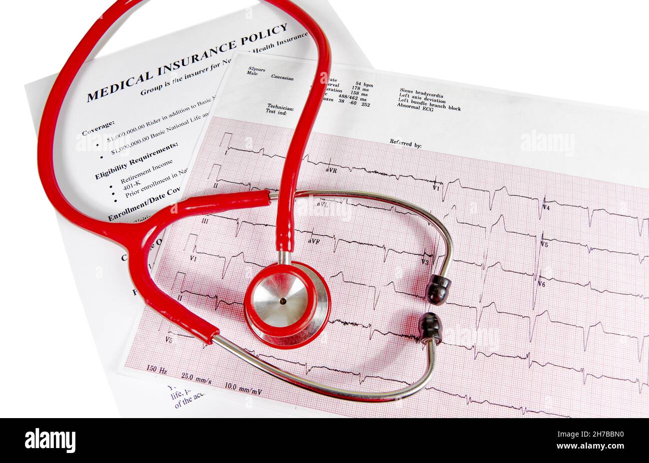 Ecocardiography report (ECG) showing irregular heartbeat with a medical insurance policy underneath and a red stethoscope on top of it isolated on whi Stock Photo