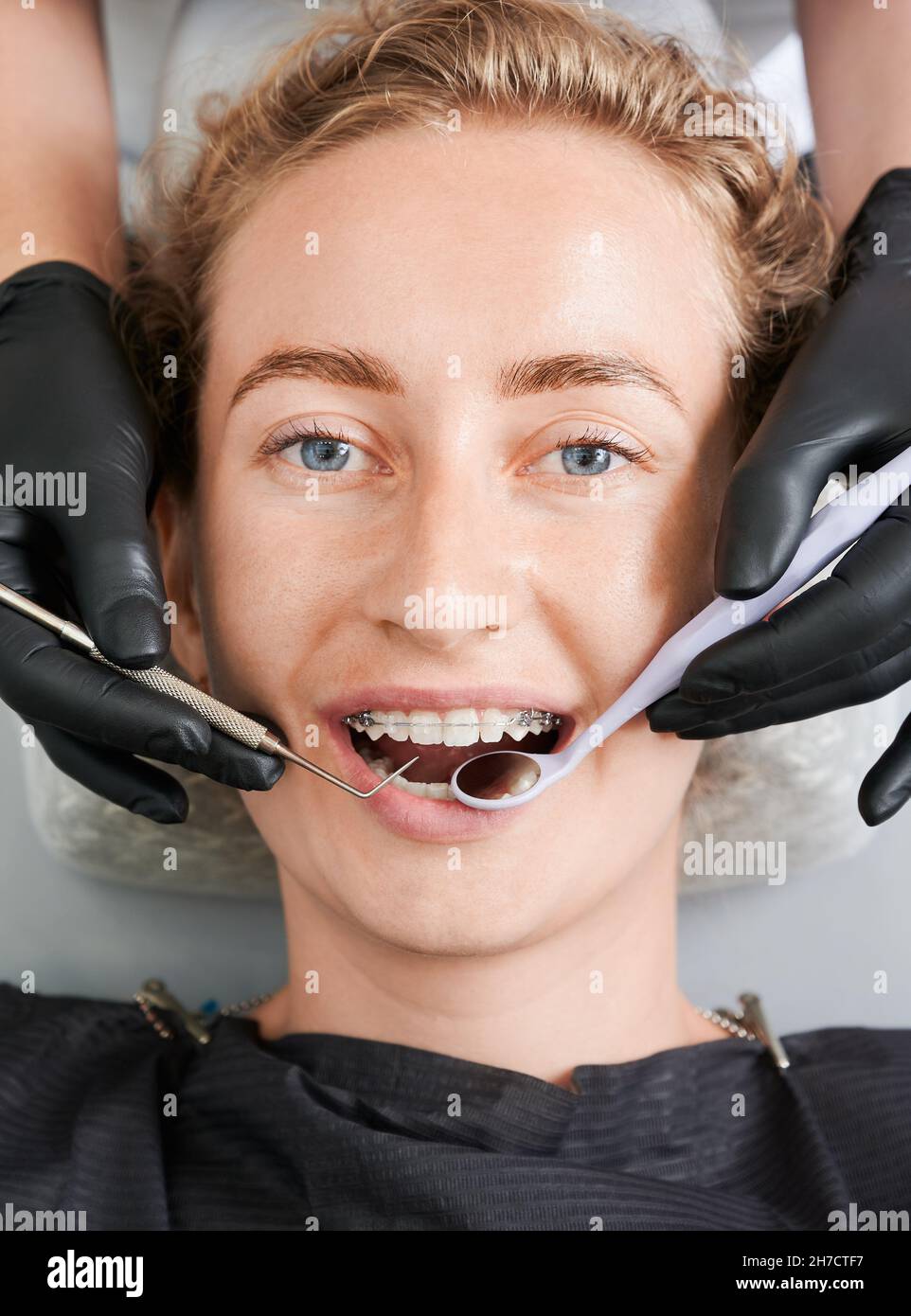 Close up of stomatologist hands using dental mirror and dental probe