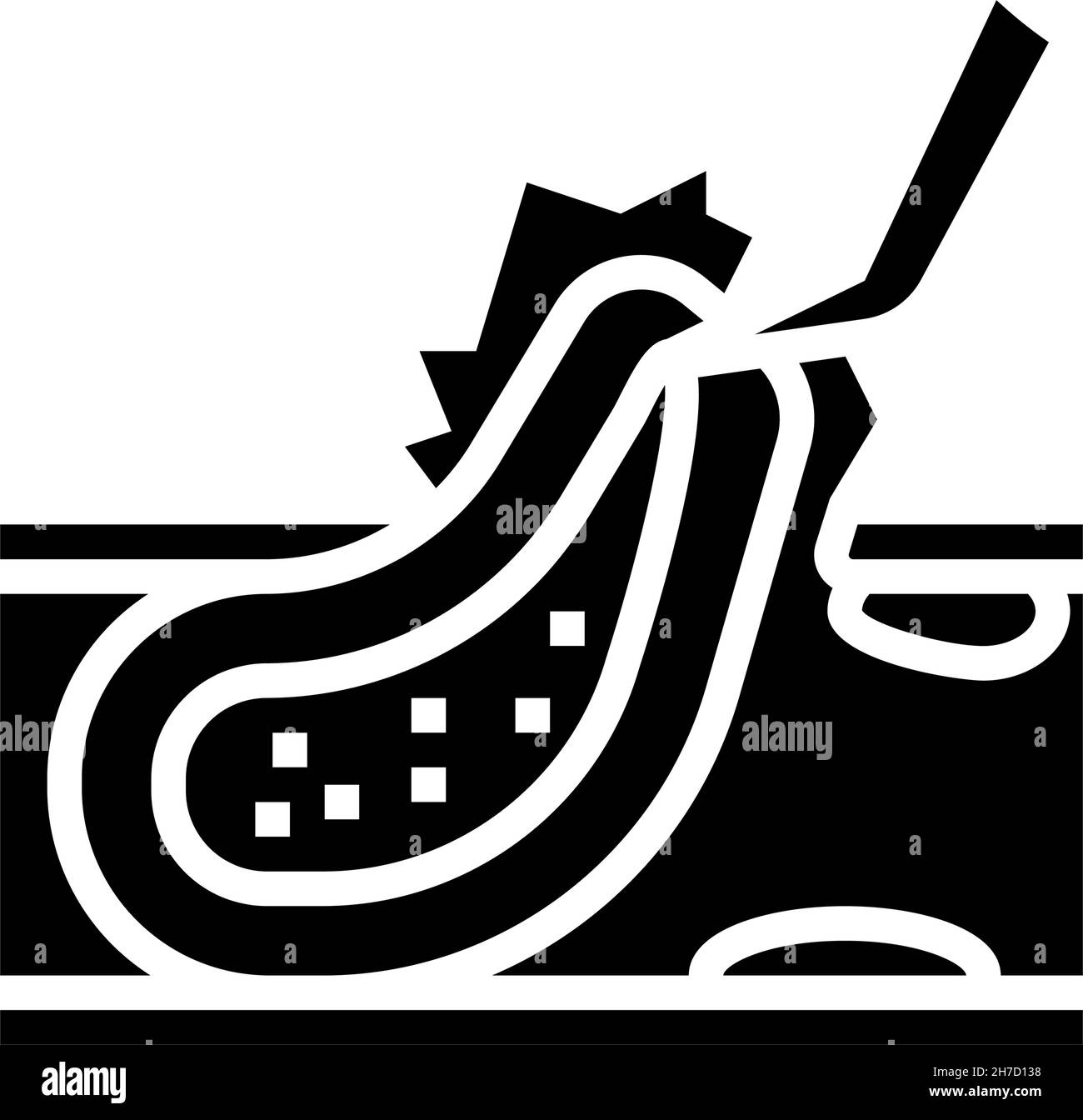 carotid endarterectomy glyph icon vector illustration Stock Vector ...