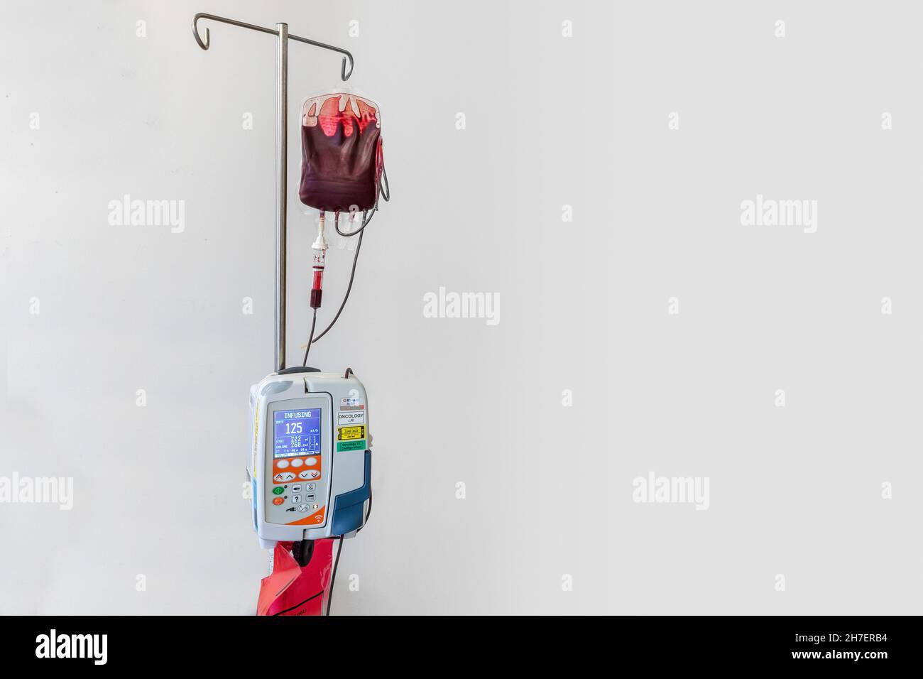 Blood transfusion in progress using Alaris Nexus GP volumetric pump with copy space Stock Photo