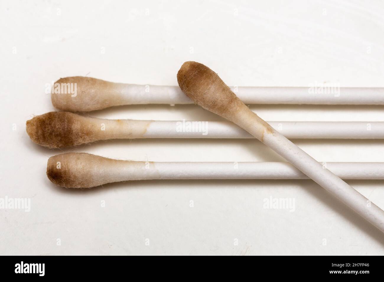 Human earwax (cerumen) hi-res stock photography and images - Alamy