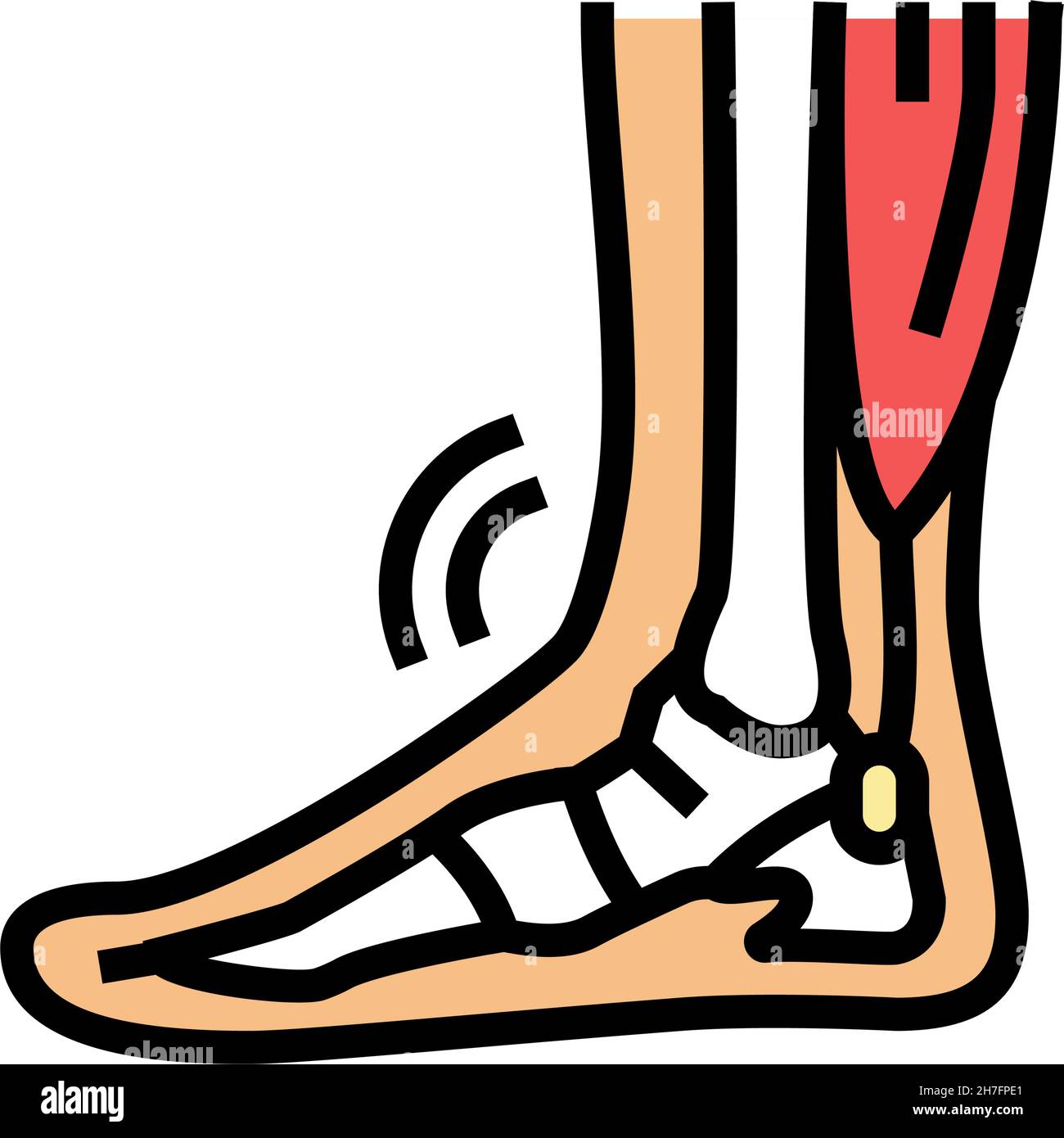 tendonitis problem color icon vector illustration Stock Vector Image ...