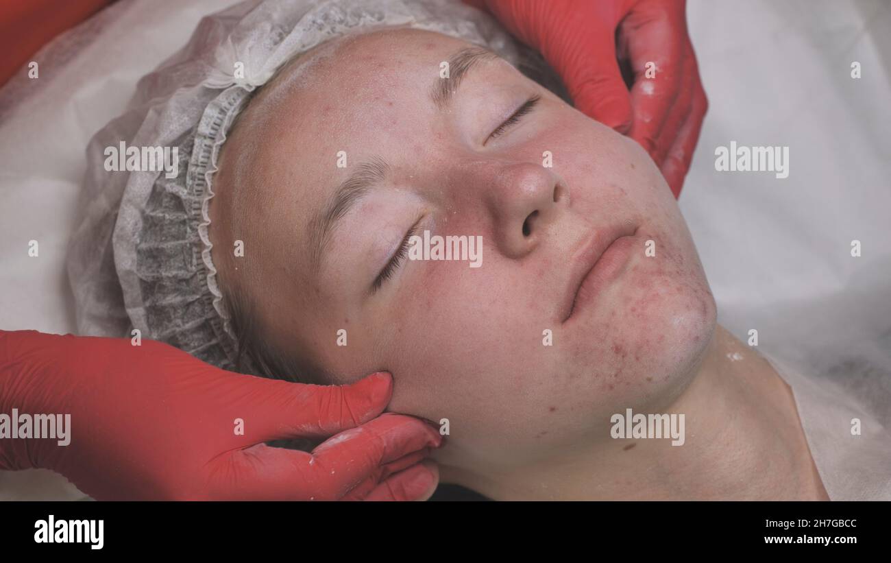 Skin Problem Powder Applying powder to the client's face and massage the client's problem ...