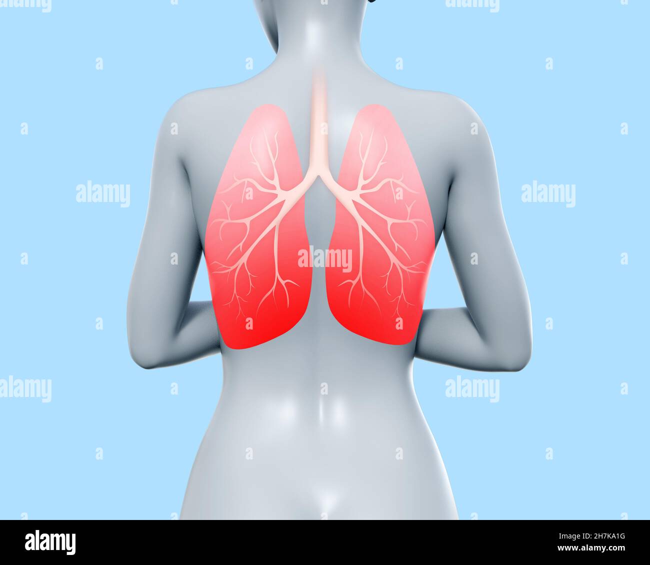 3d render illustration of female figure standing with infammated lungs area on blue background. Stock Photo