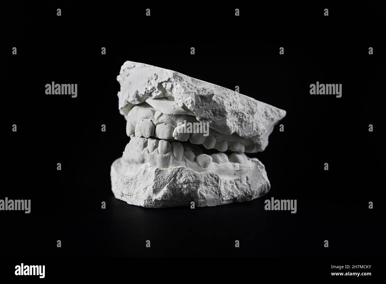 Cast of the jaw made of plaster on black background. Teeth cast for