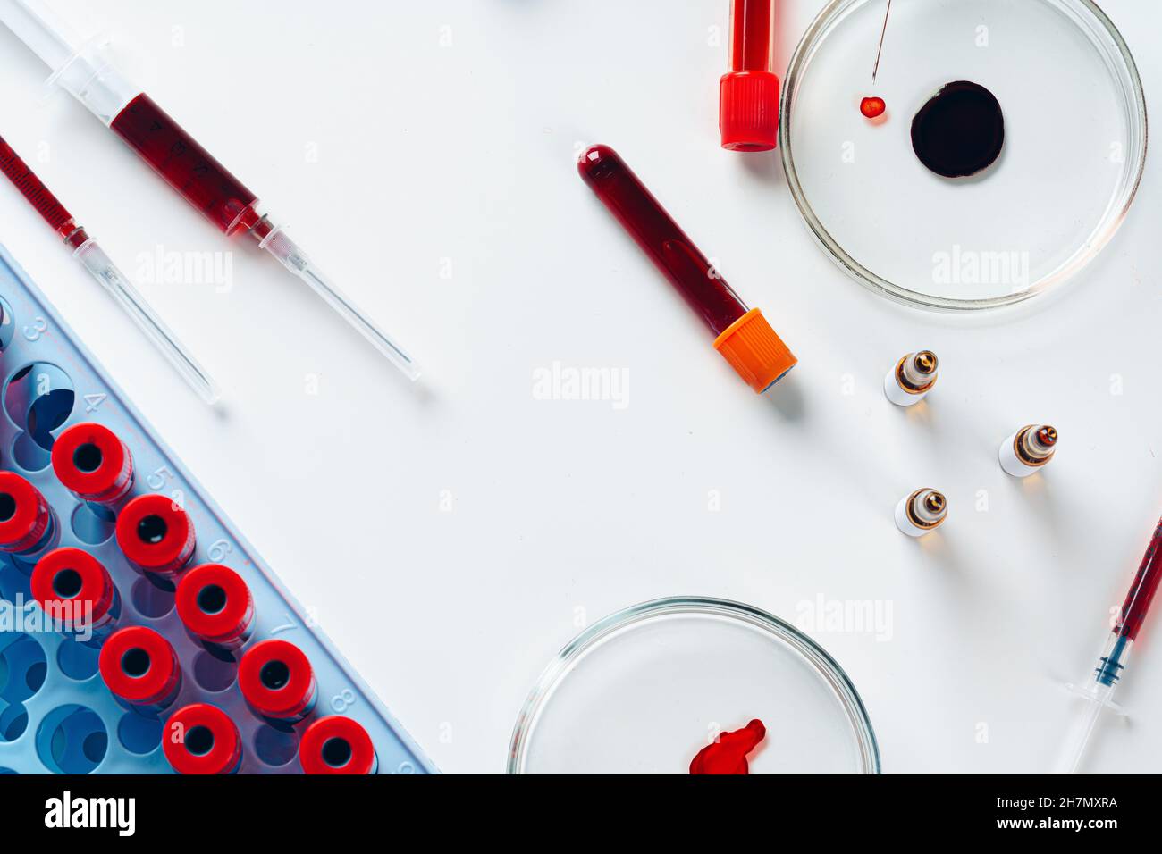 Blood test analysis with Petri dish close up Stock Photo - Alamy