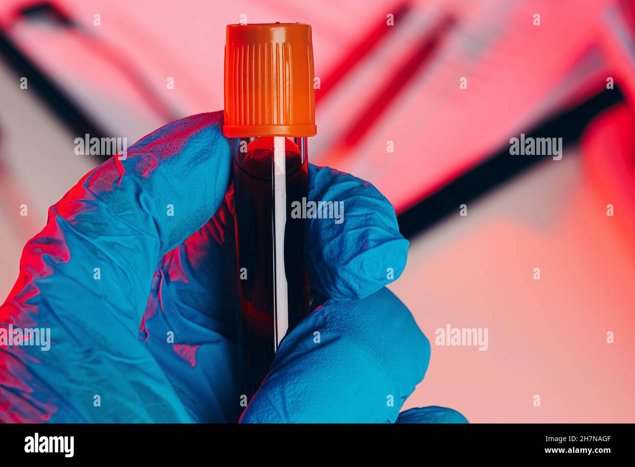 Doctor's hands in blue gloves keep test tube with a blood Stock Photo