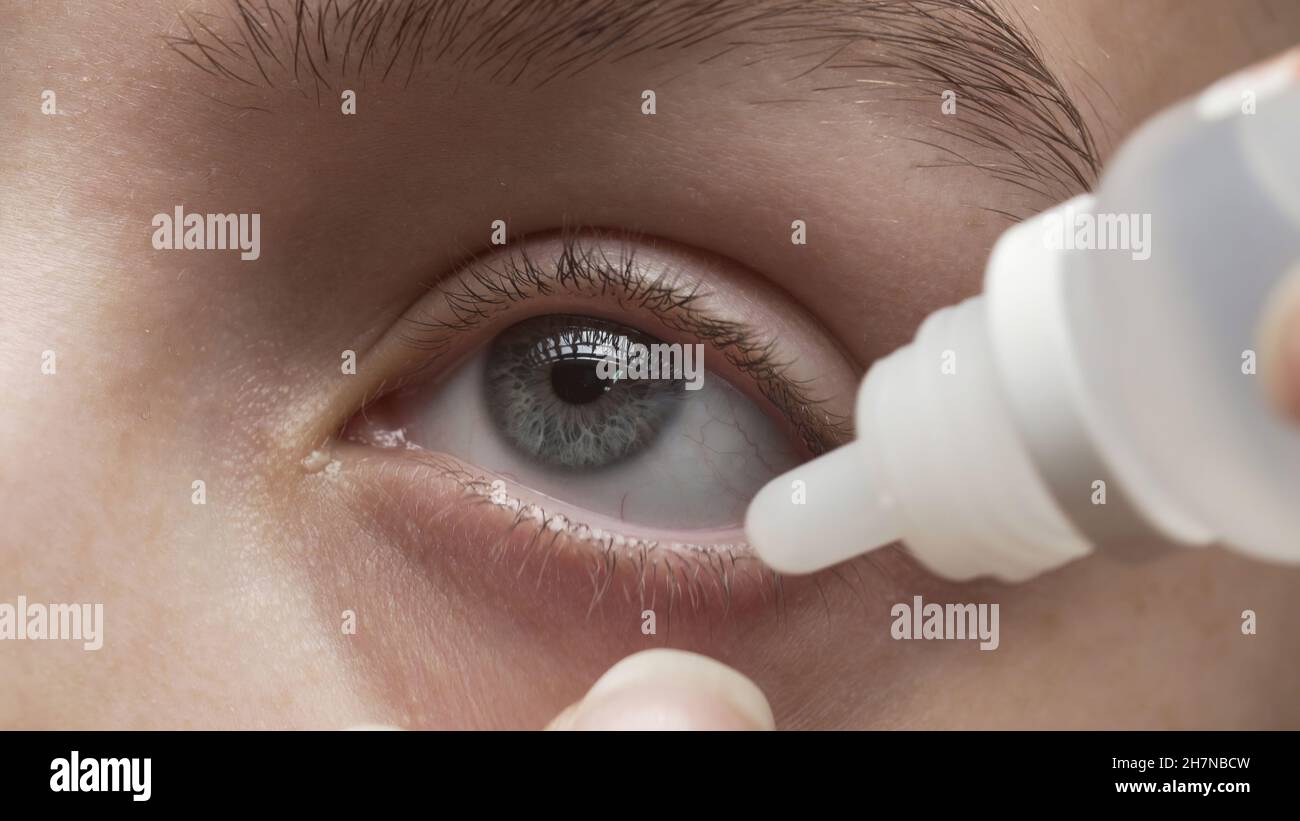 Close-up photo of young girl dripping her eyes Stock Photo