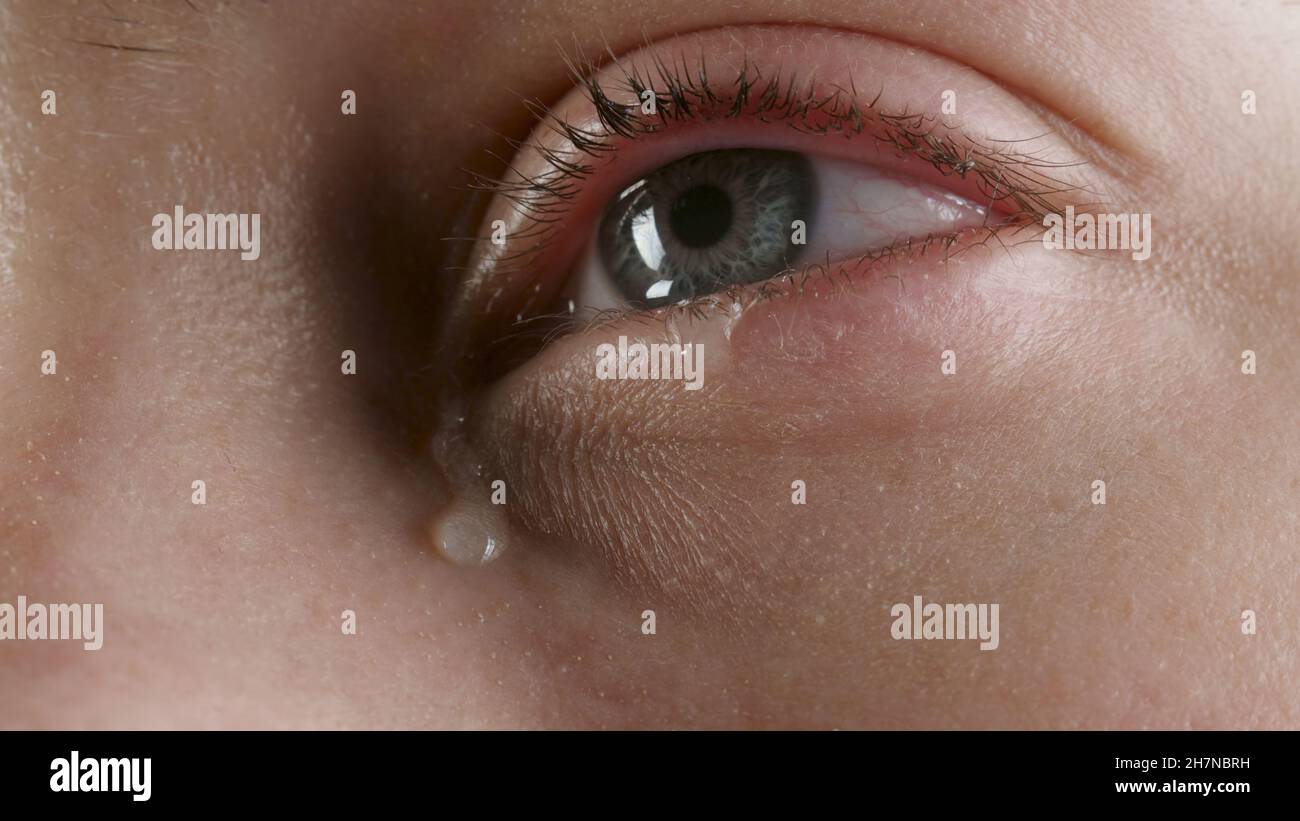 Closeup photo of the woman's tearing eye Stock Photo Alamy