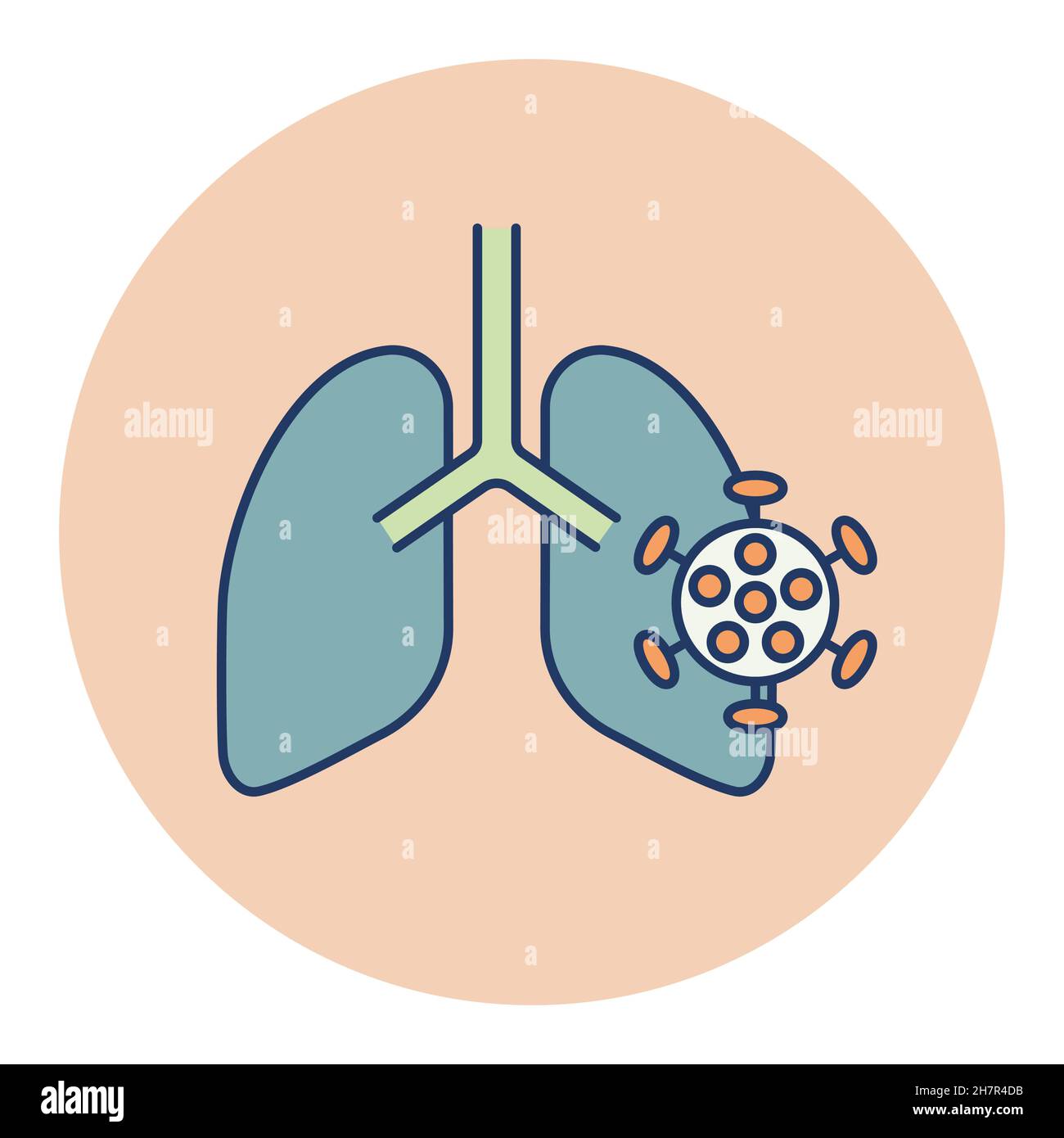 Human lungs infected by virus and bacteria isolated vector icon ...