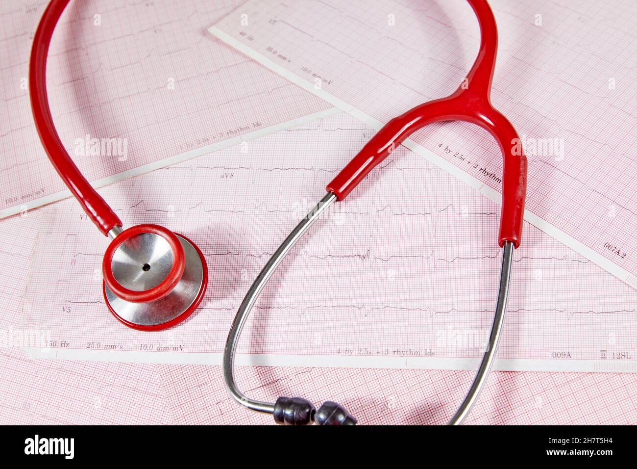 Ecocardiography report (ECG) showing irregular heartbeat with  a red stethoscope on top of it Stock Photo