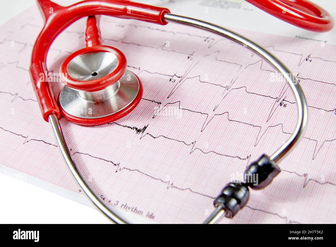 Ecocardiography report (ECG) showing irregular heartbeat with  a red stethoscope on top of it Stock Photo