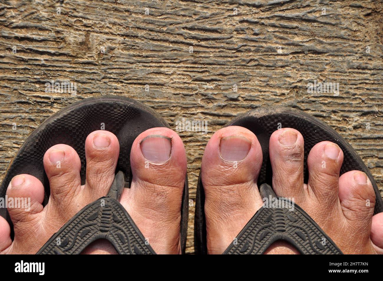 Asian Long Toes