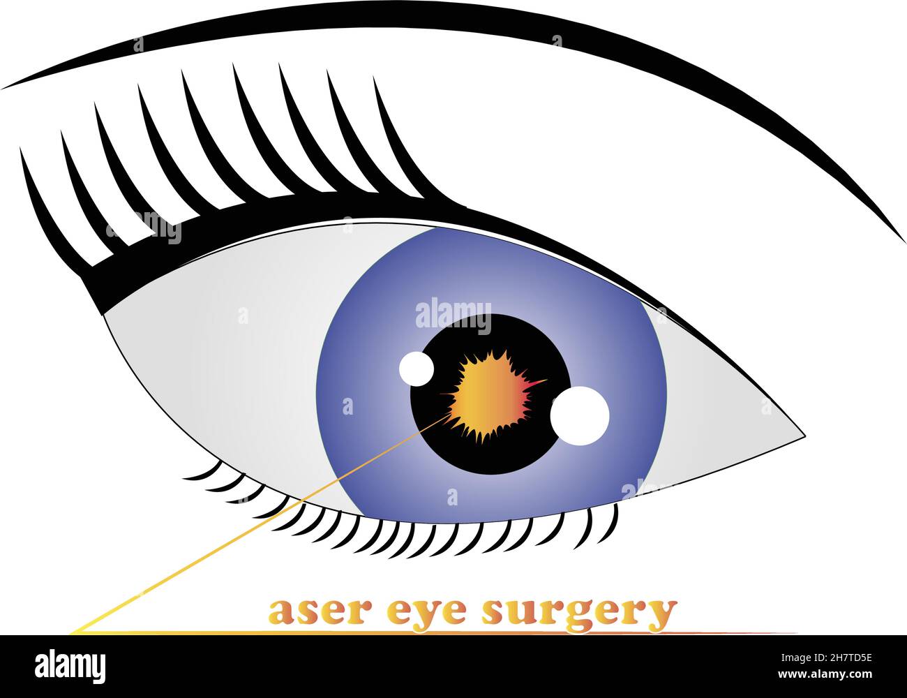 Laser eye surgery logo vector illustration Stock Vector Image & Art Alamy