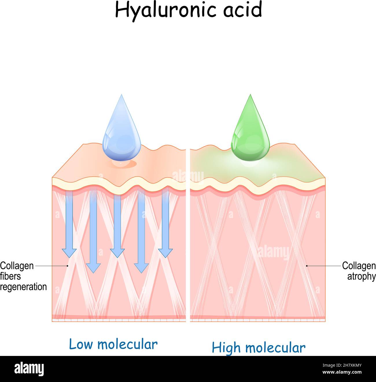 Hyaluronic acid. skin rejuvenation with help of skin-care products. Low molecular and High molecular Stock Vector