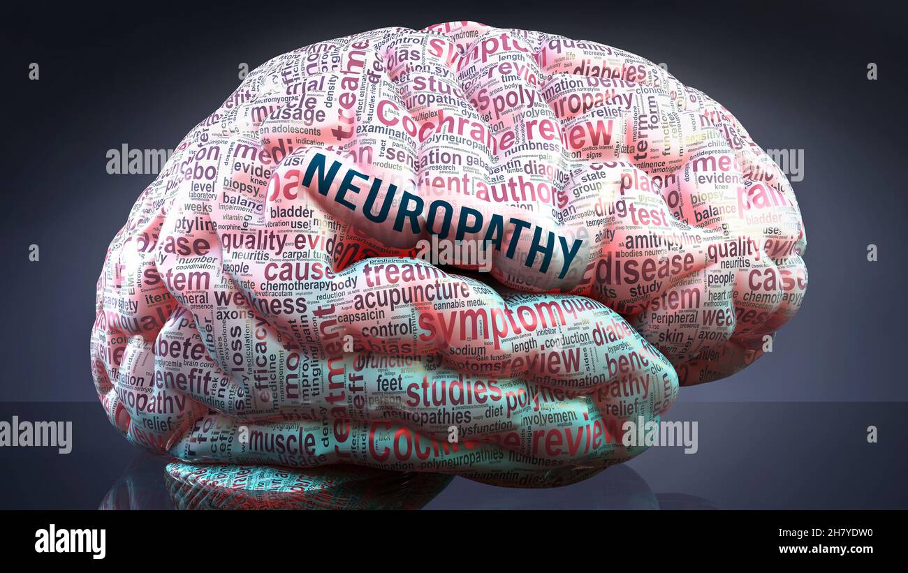Neuropathy in human brain hires stock photography and images Alamy