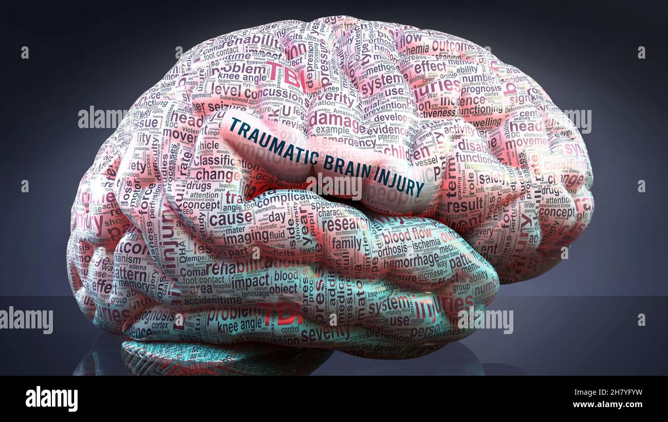 Traumatic brain injury in human brain, hundreds of terms related to Traumatic brain injury projected onto a cortex to show broad extent of this condit Stock Photo