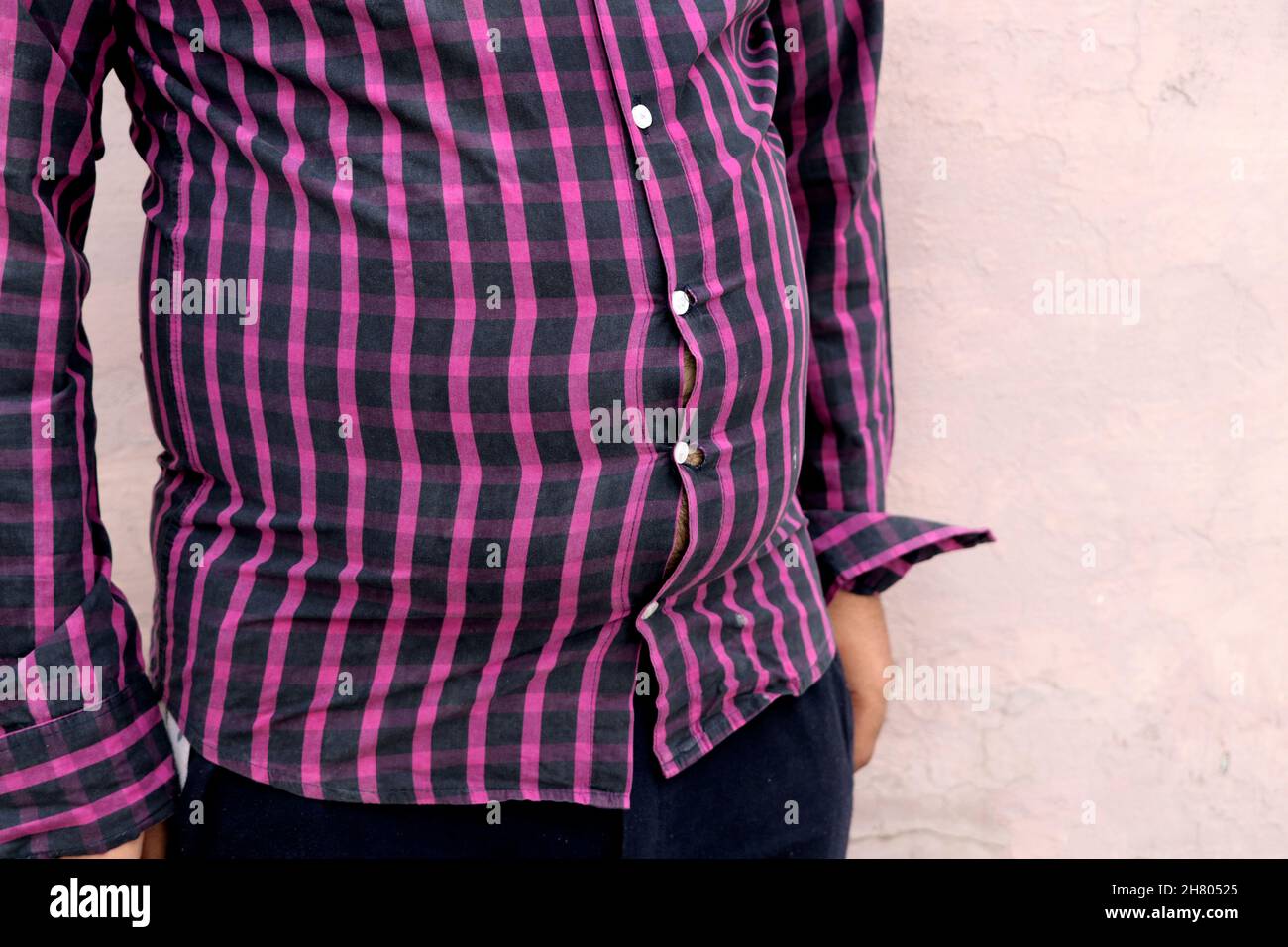 A Fat man wearing tight shirt, appearance insecurities, hormonal dis balance Stock Photo