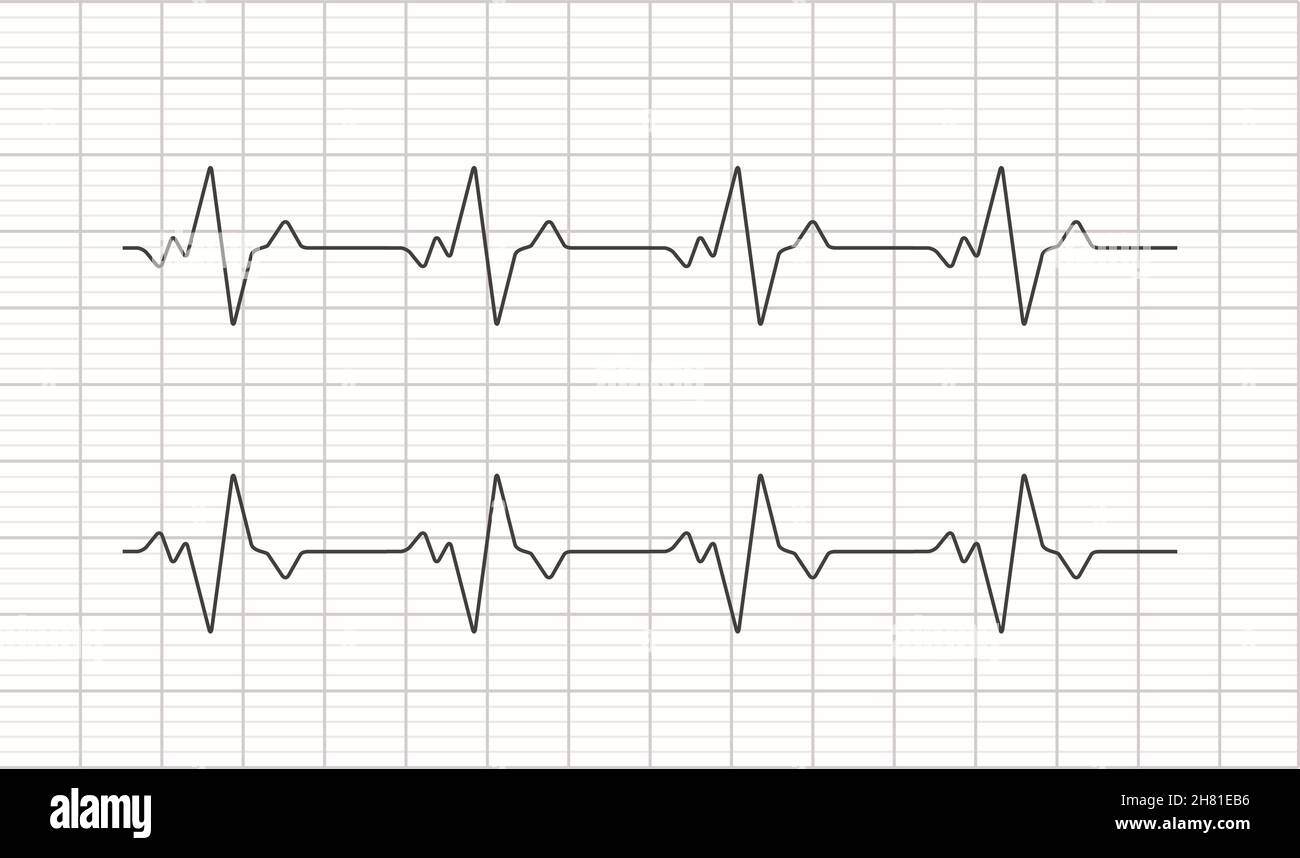 Heartbeat ecg electrocardiogram vector graph wave line. Ekg cardio heart beat cardiology frequency monitor Stock Vector
