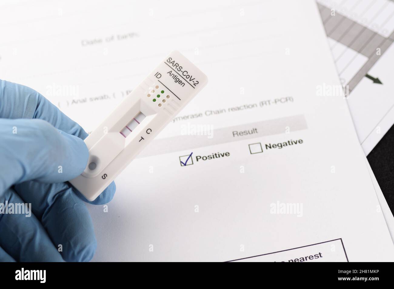 Close-up of positive result by rapid antigen test for SARS-CoV-2, COVID-19, held in hand over test document paper. COVID-19, testing, medicine, pandem Stock Photo