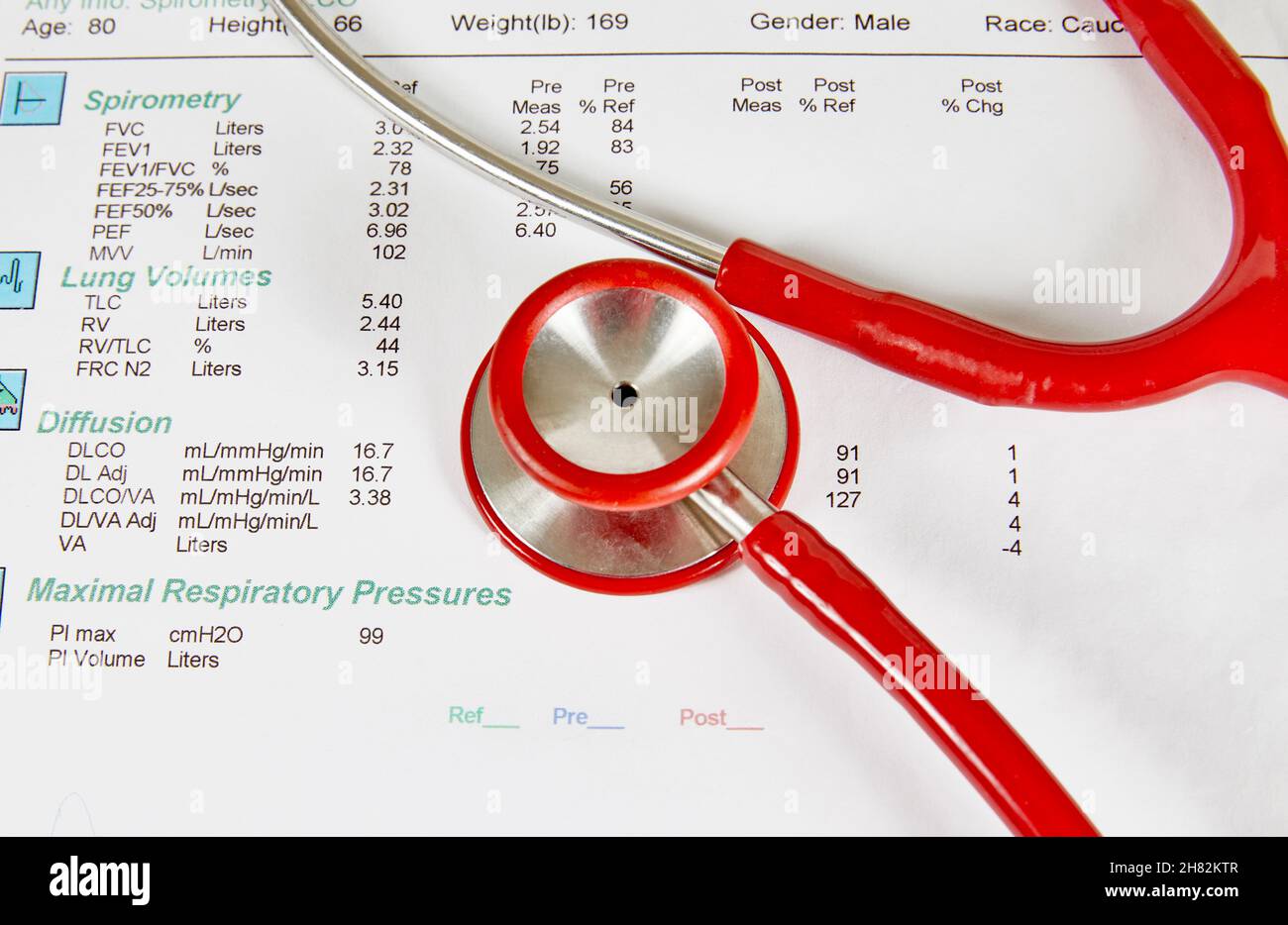 Pulmonary Function analysis report with  a red stethoscope on top of it Stock Photo