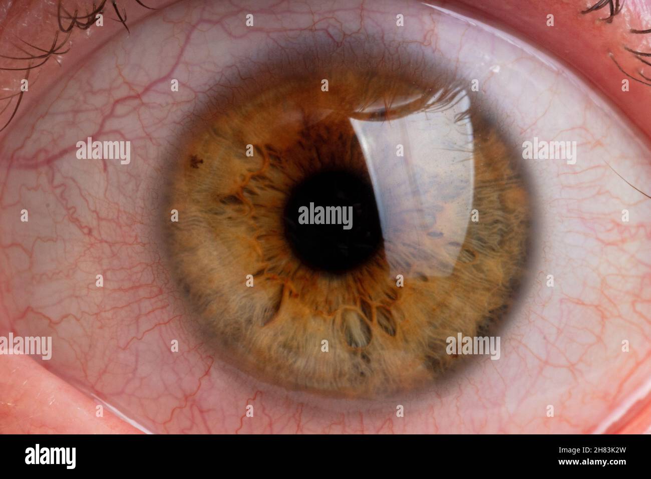 human pupil close up, blood vessels in the white of the eye Stock Photo ...