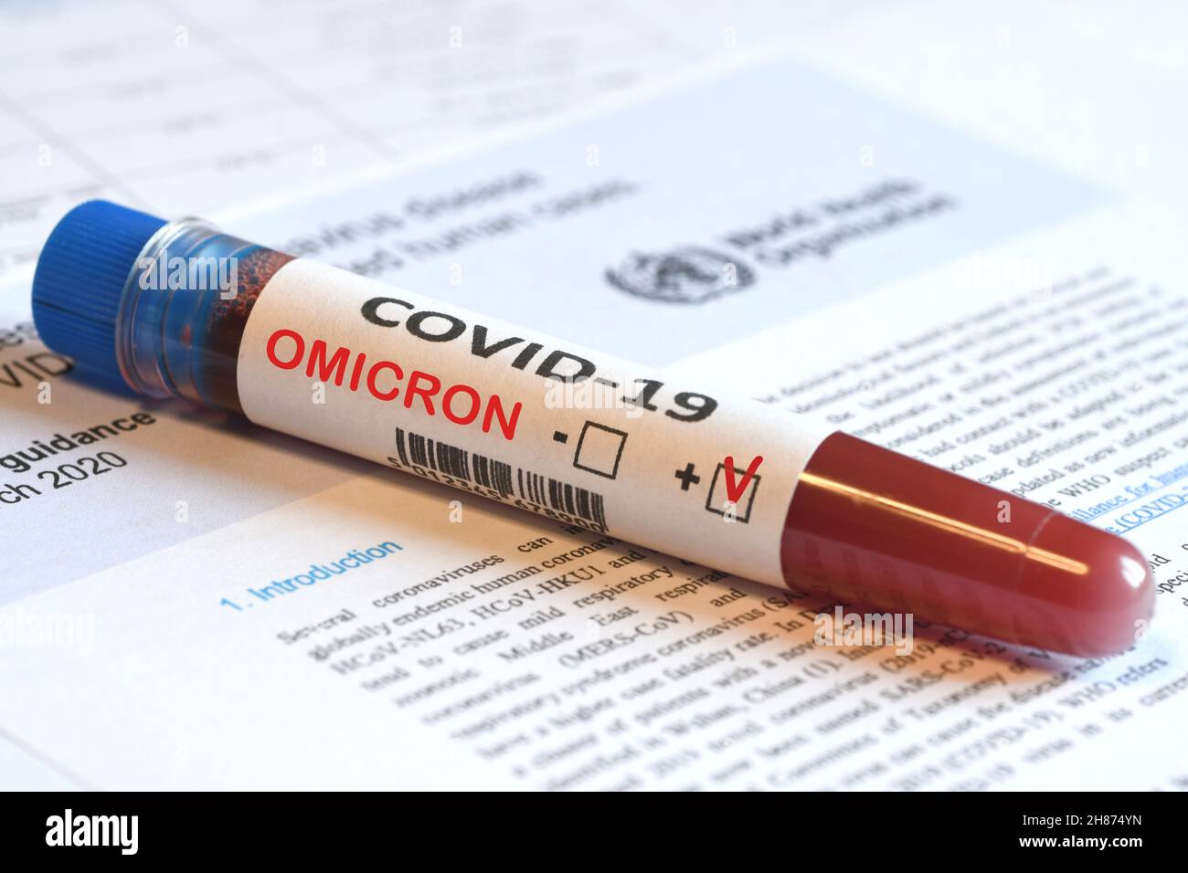 Blood tube for test detection of virus Covid-19 Omicron Variant with positive result on papers document. Stock Photo