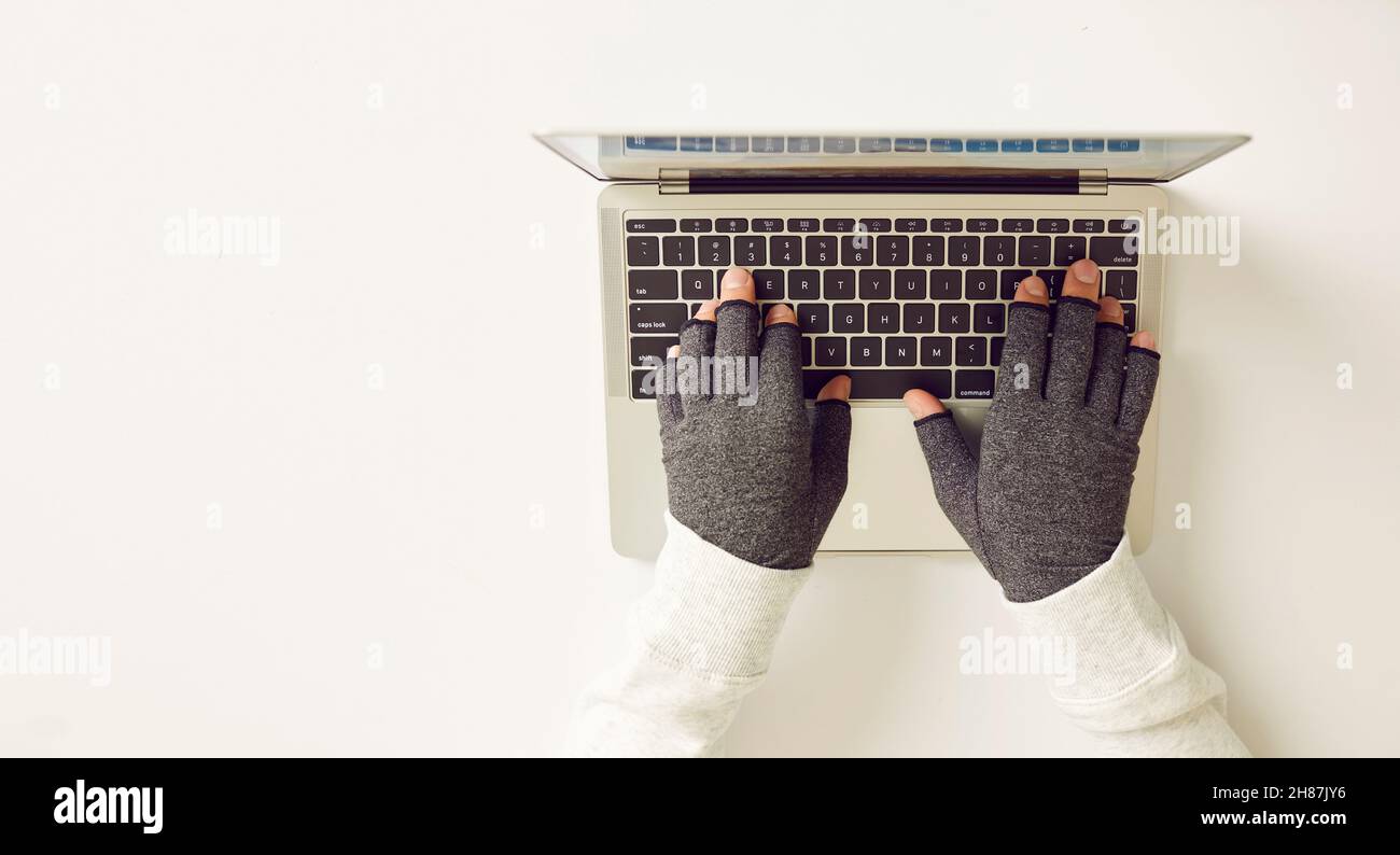 Man with rheumatoid arthritis wearing compression gloves while working on computer Stock Photo