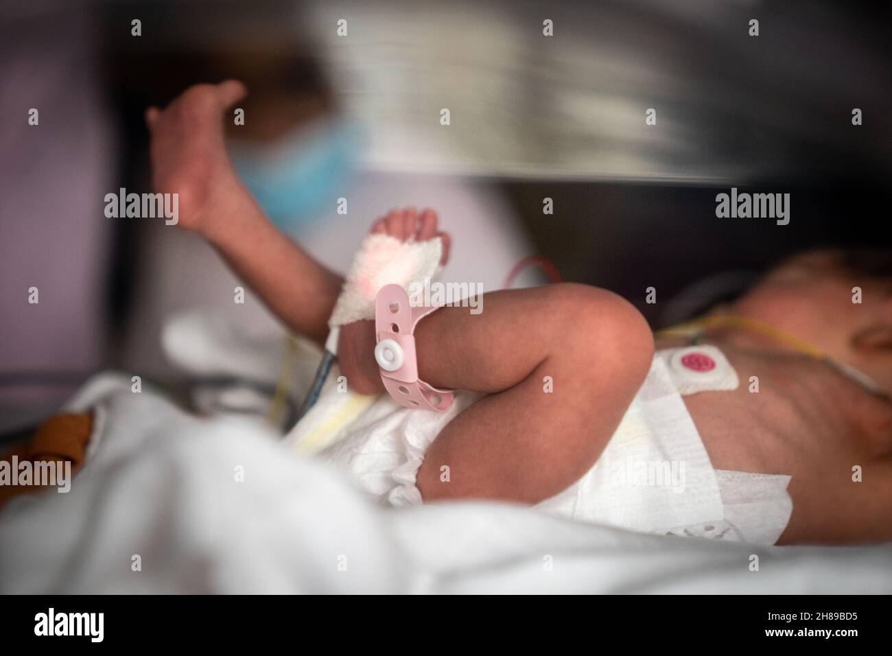 Neonatal Stock Photo