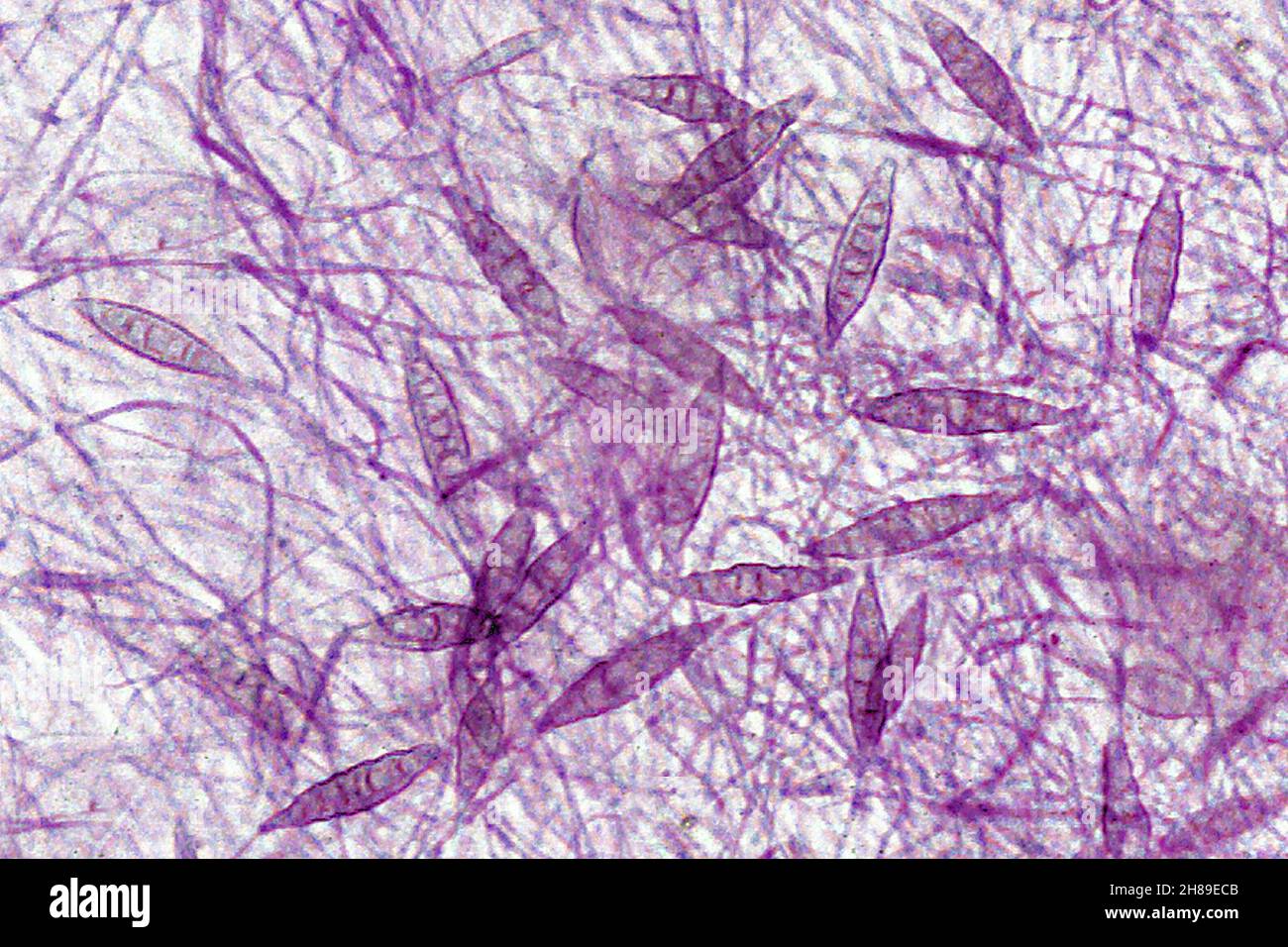 Microsporum Stock Photo