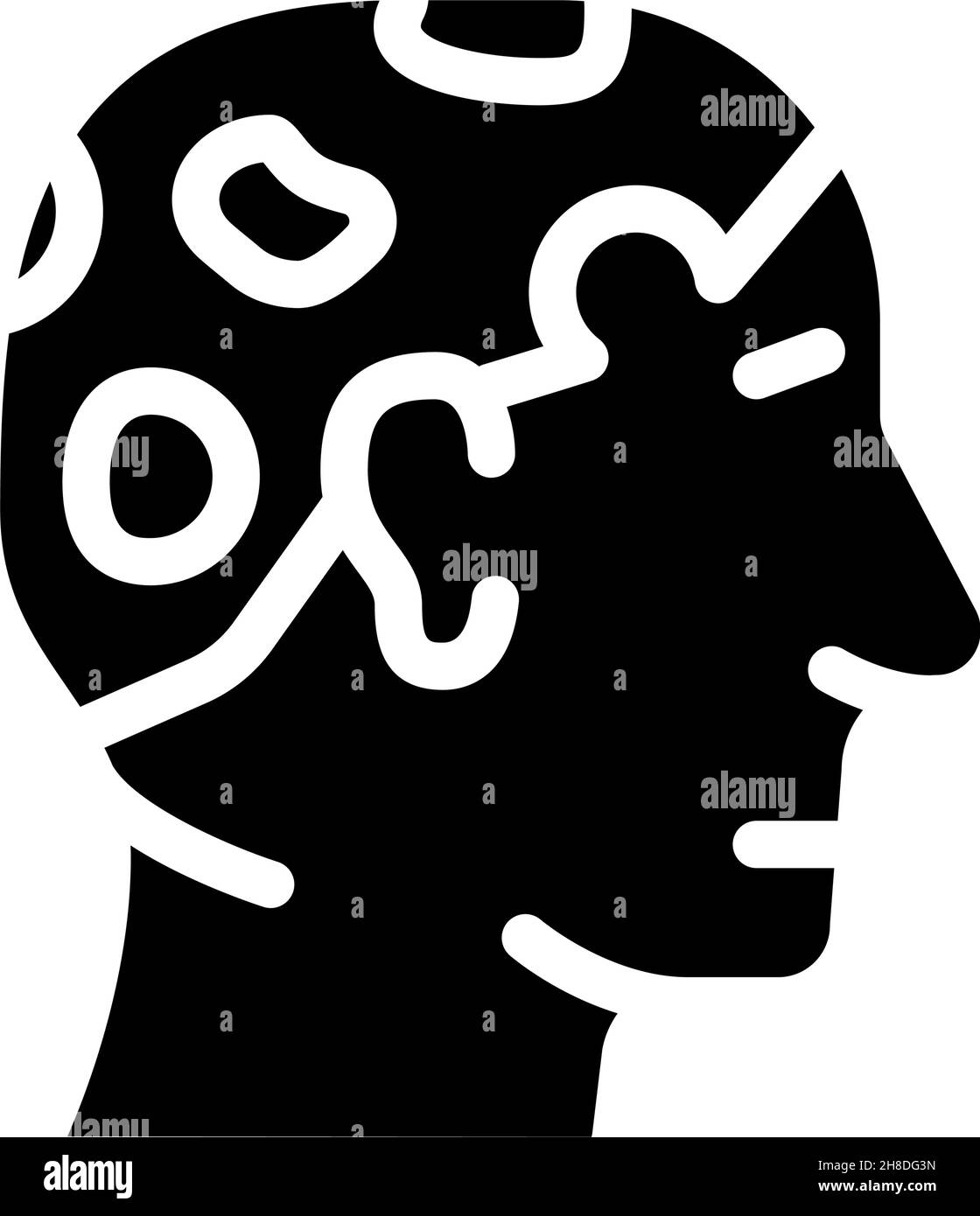 alopecia areata glyph icon vector illustration Stock Vector