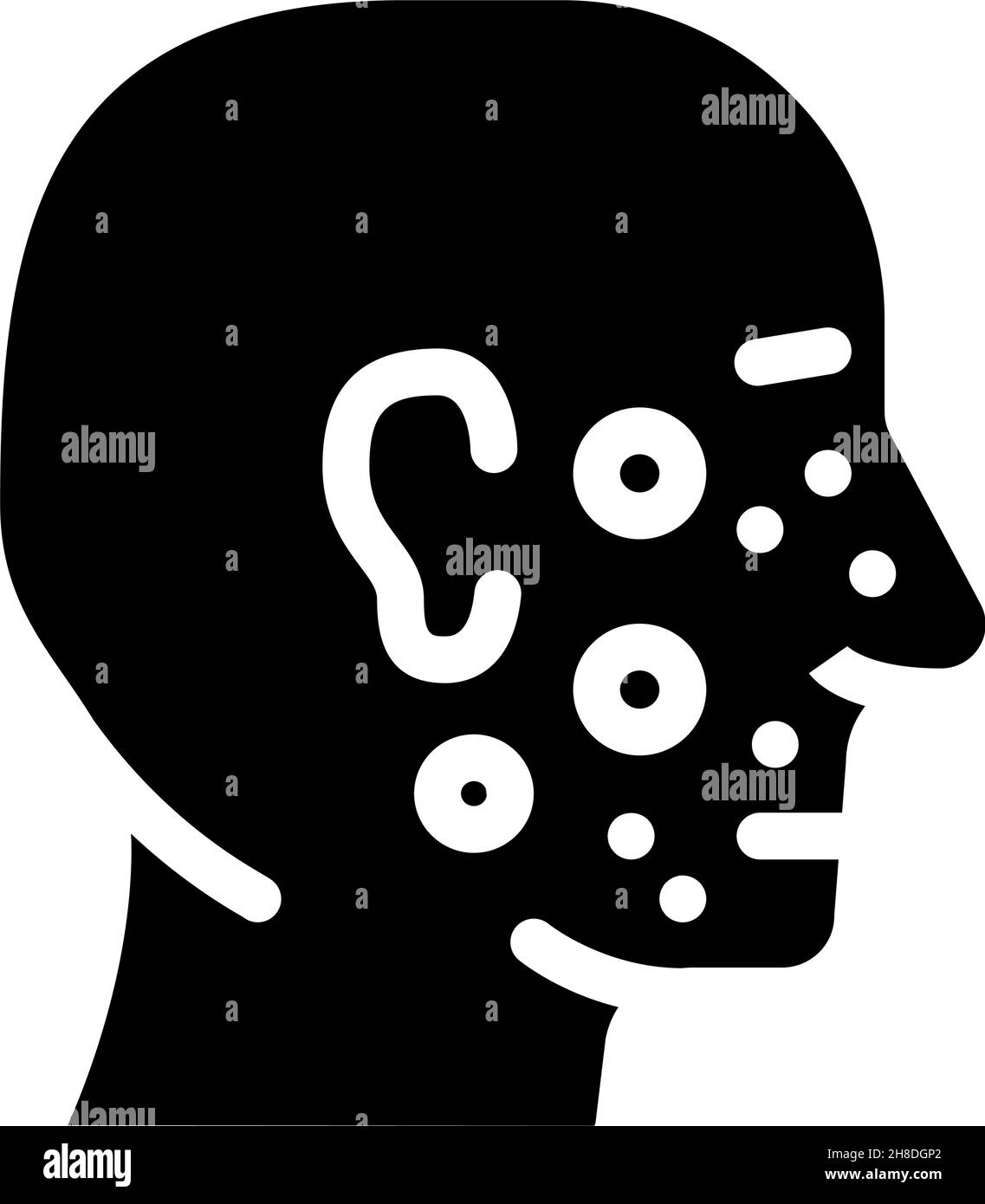 acne facial skin disease glyph icon vector illustration Stock Vector