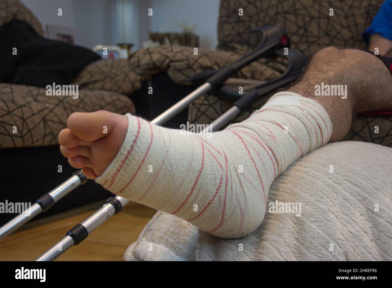 Fractured ankle hi-res stock photography and images - Page 2 - Alamy