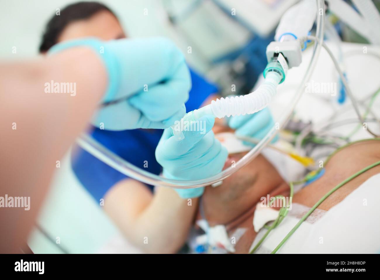 Medical doctor with assistant intubates male patient in the critical care unit. Stock Photo