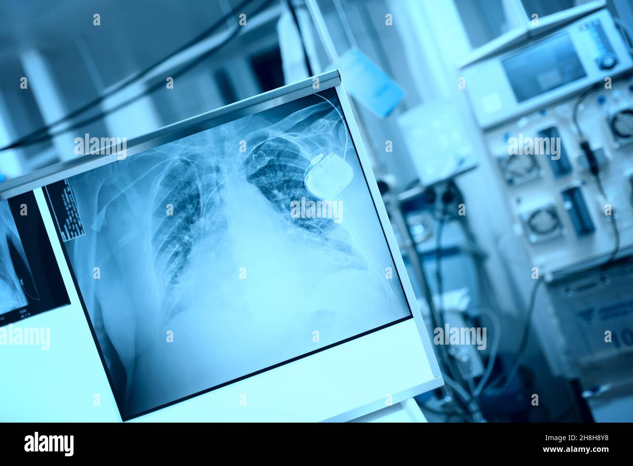 X-ray film on the light board in the equipped medical room. Stock Photo