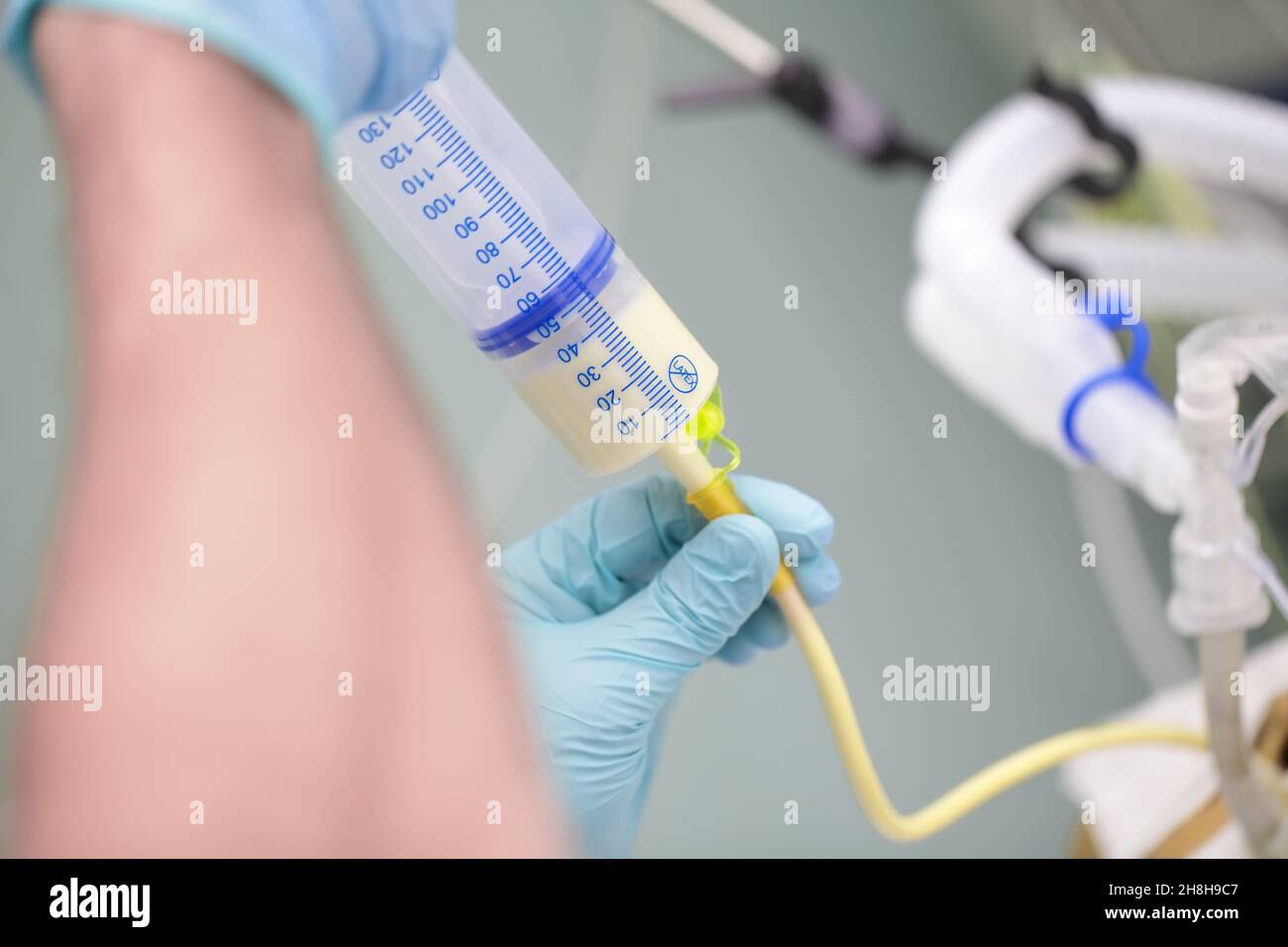 Feeding tube patient hires stock photography and images Alamy